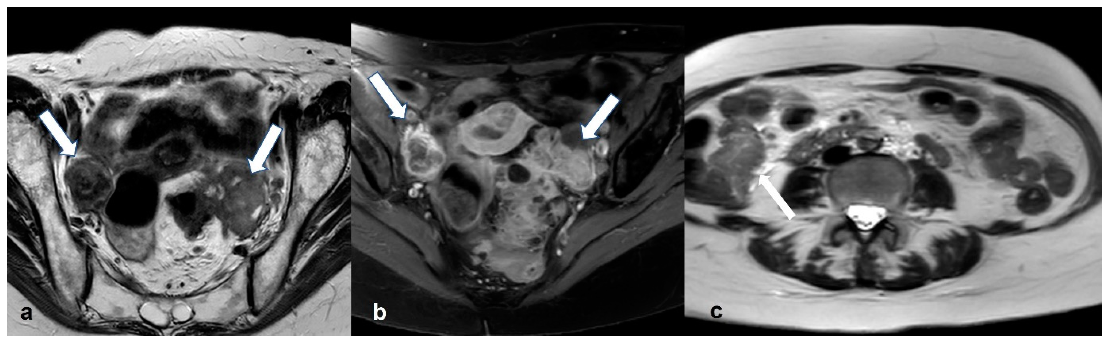 Cancers 15 02106 g022