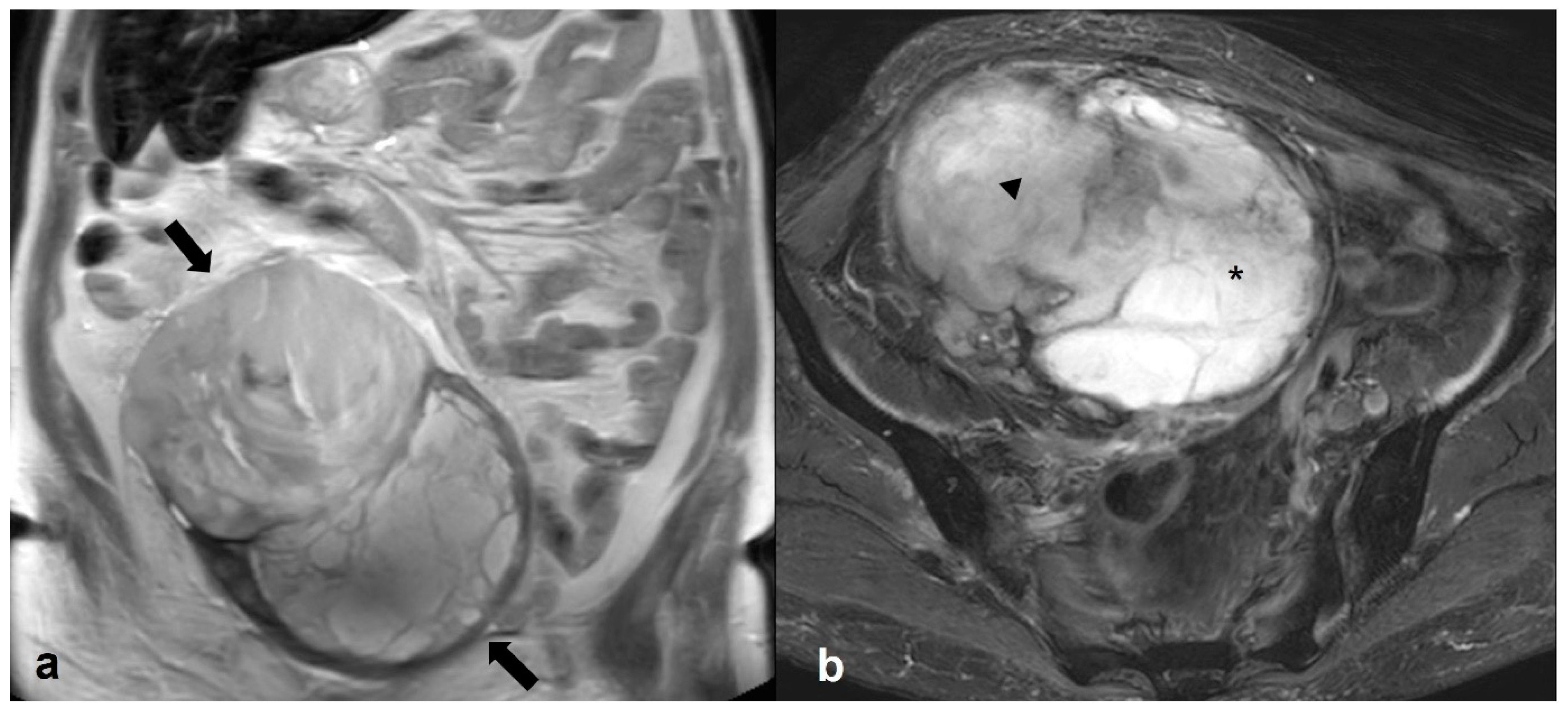 Cancers 15 02106 g023