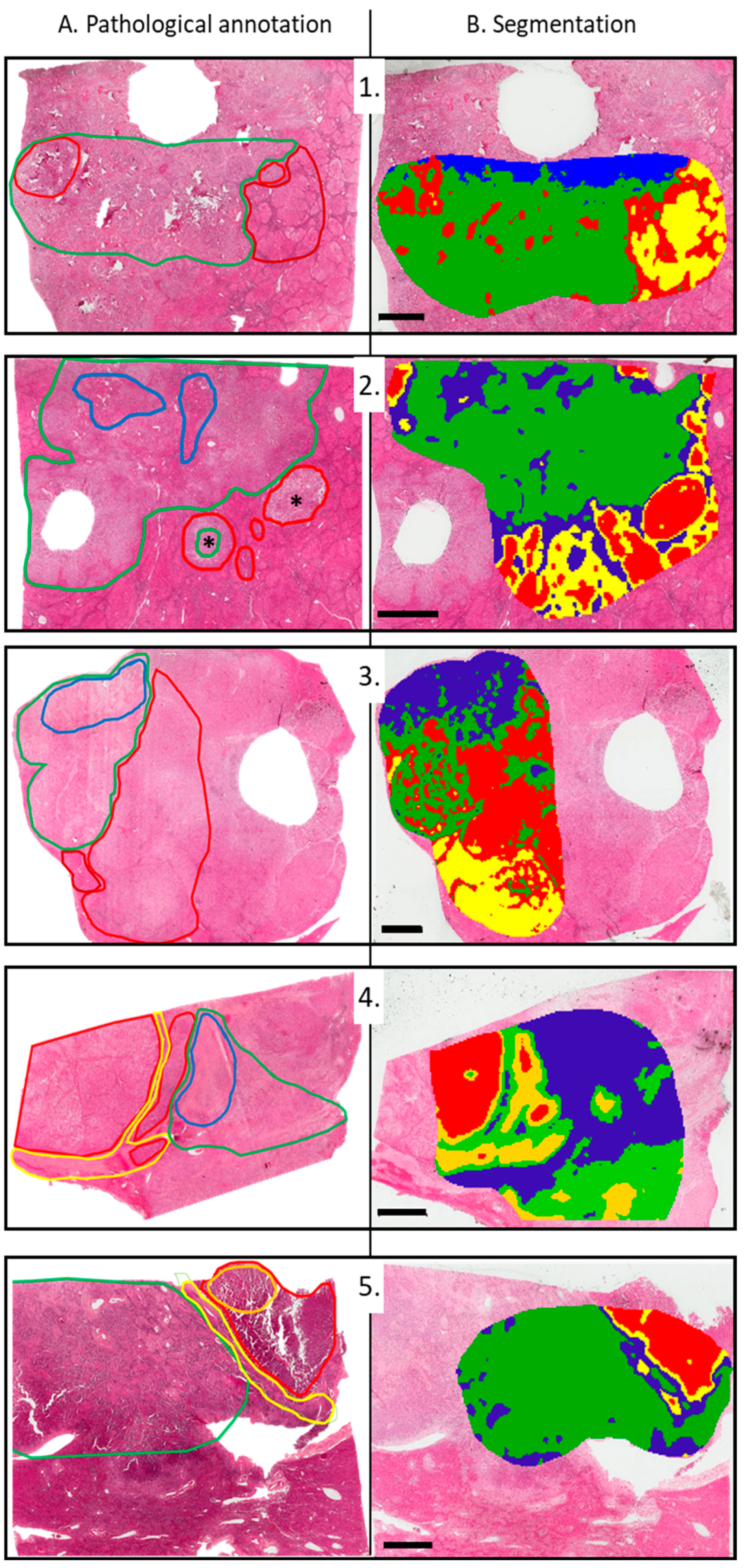 Cancers 15 02143 g002