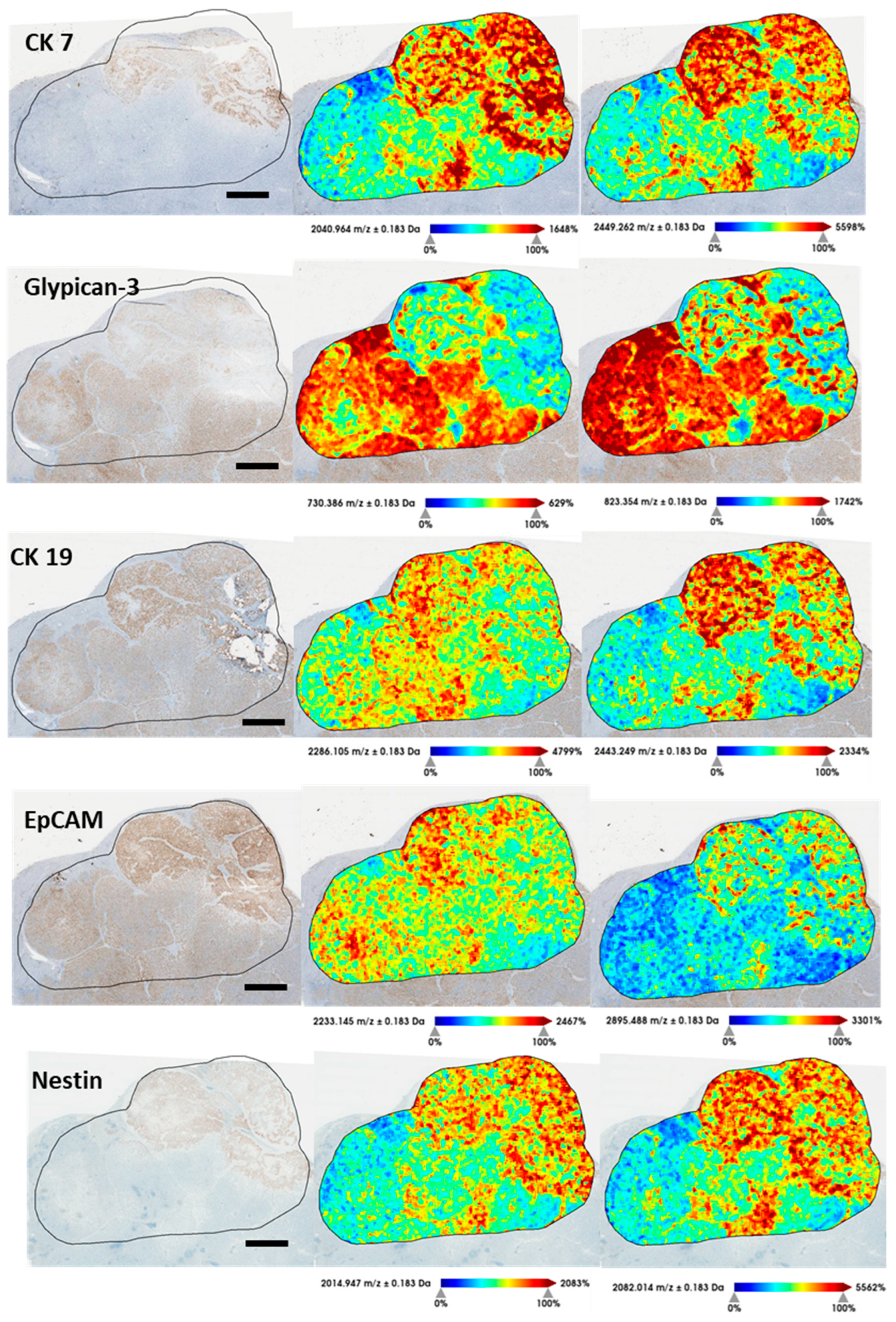 Cancers 15 02143 g005