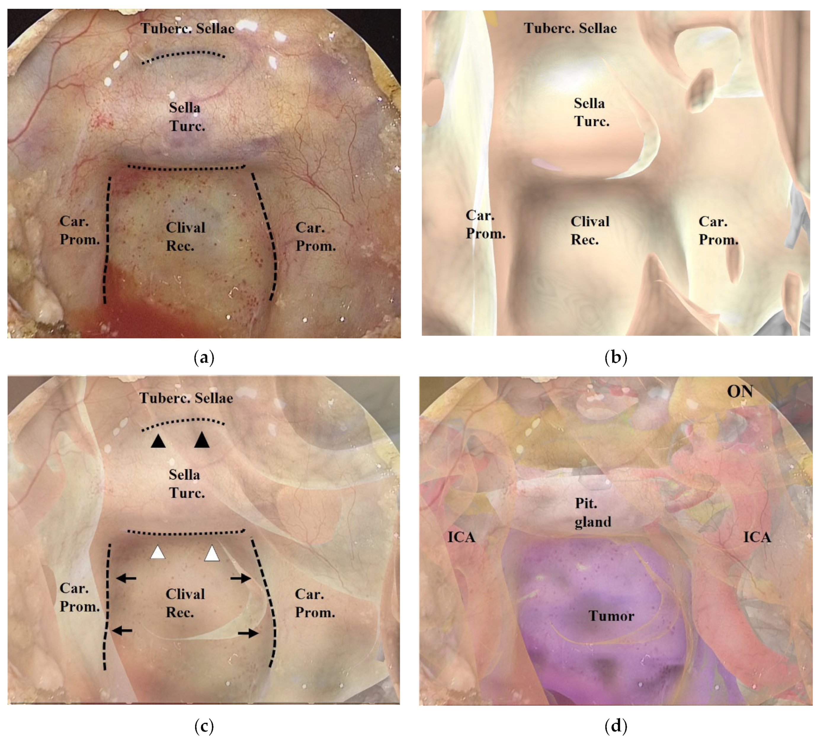 Cancers 15 02148 g002 Cancers 15 02148 g002