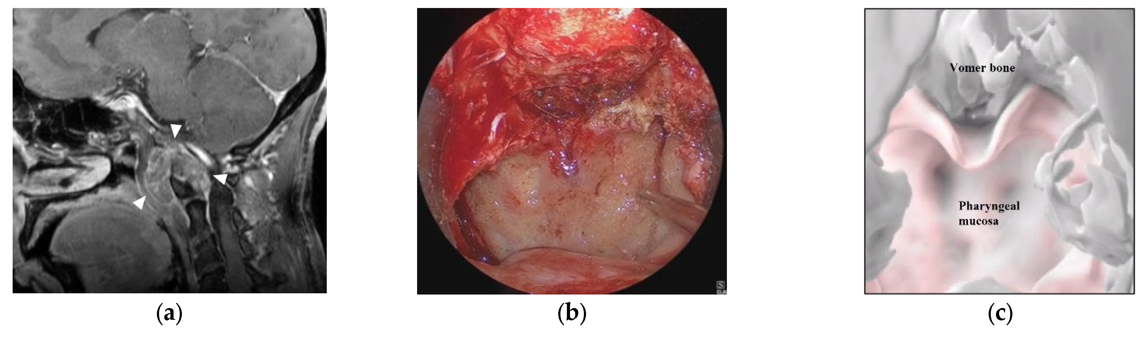 Cancers 15 02148 g005a Cancers 15 02148 g005a