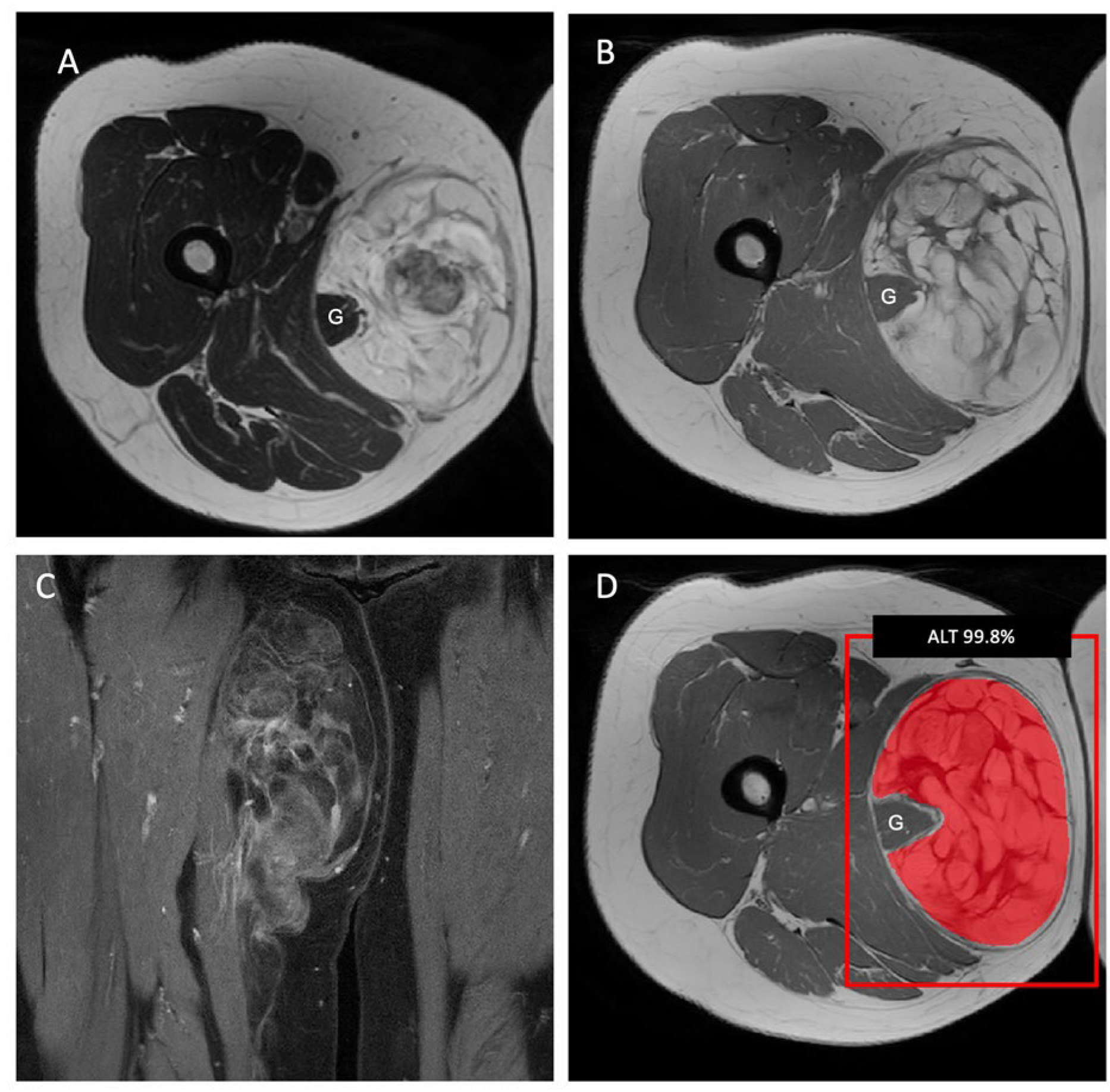 Cancers 15 02150 g003