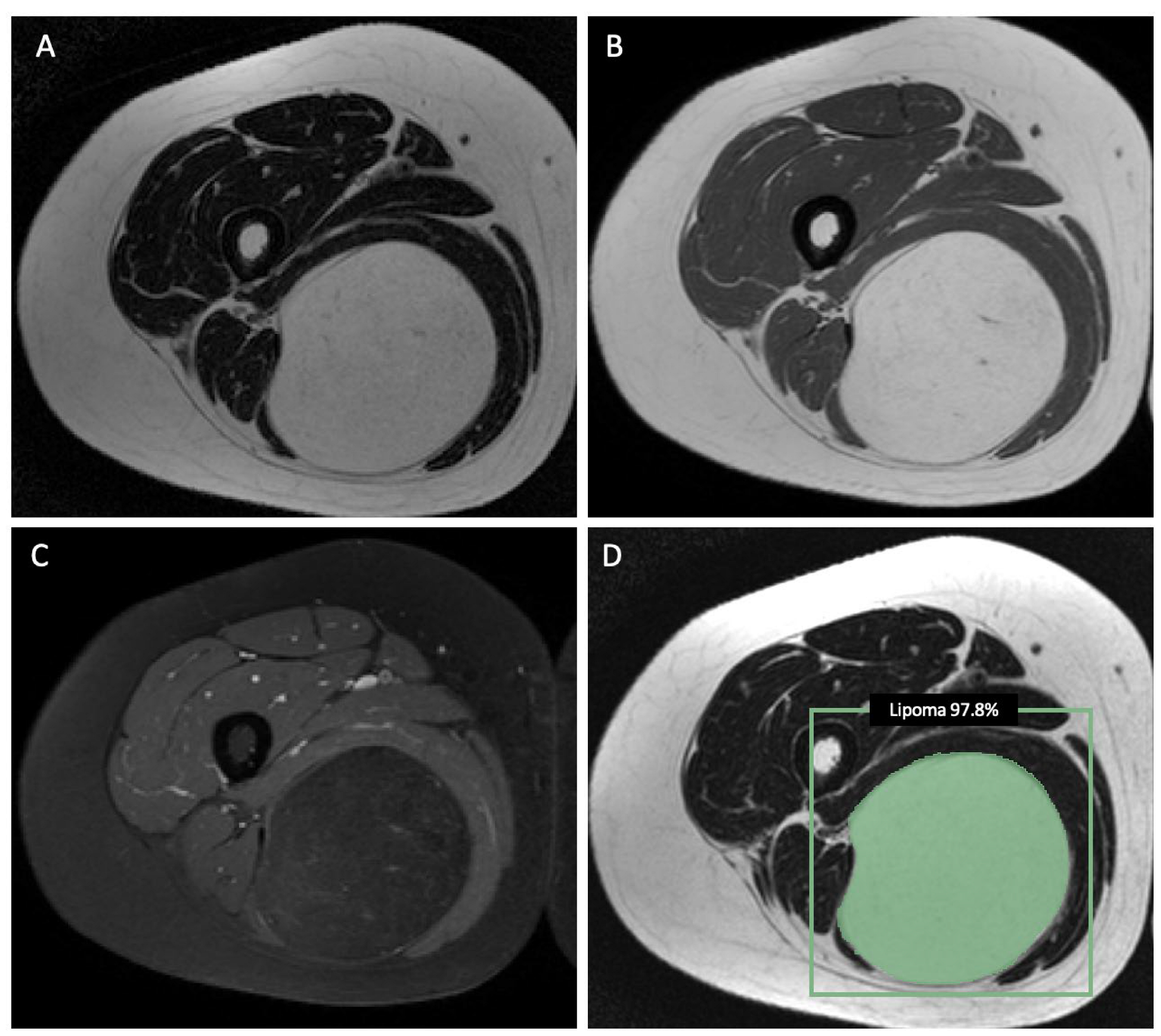 Cancers 15 02150 g004