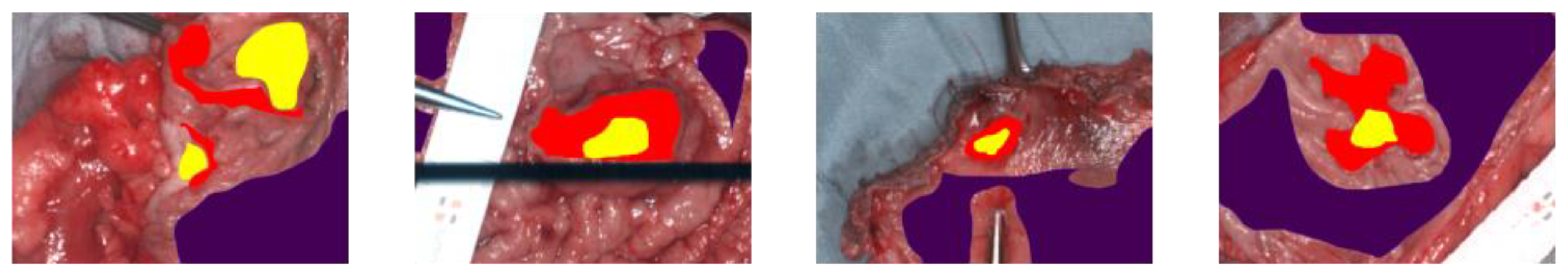 Cancers 15 02157 g001