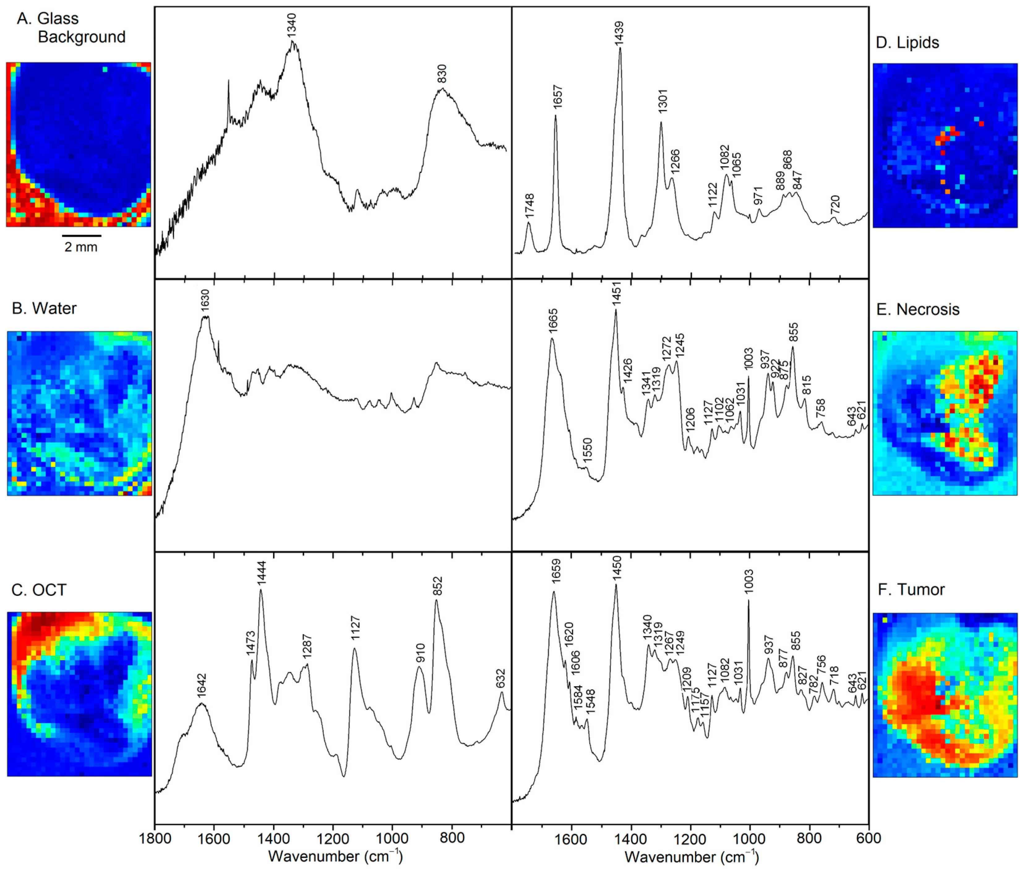Cancers 15 02162 g003 Cancers 15 02162 g003
