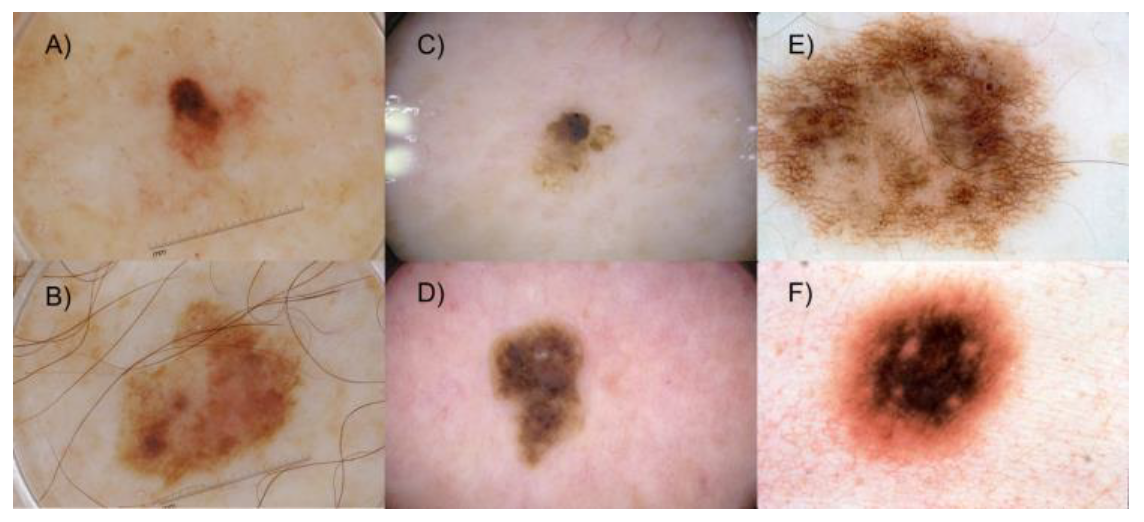 Cancers 15 02174 g003