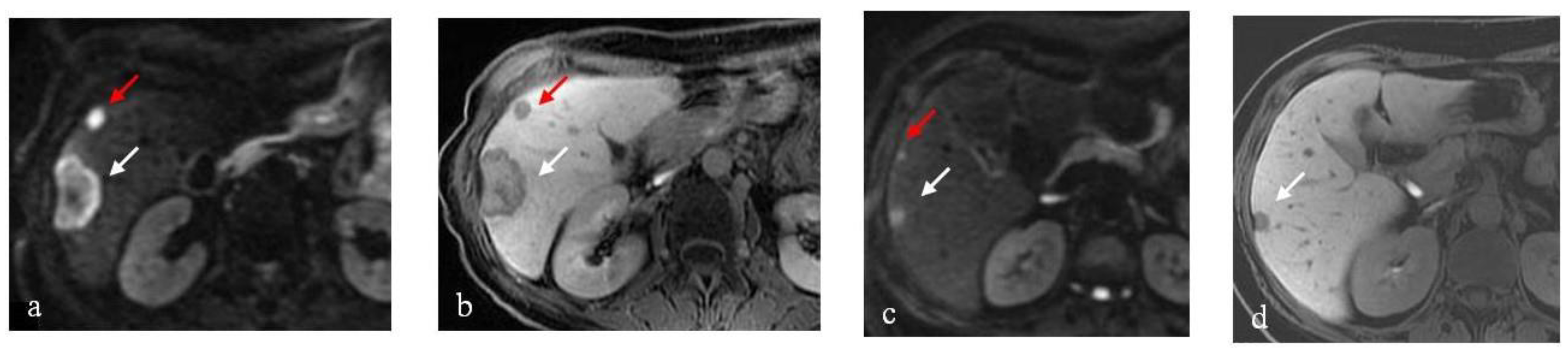 Cancers 15 02200 g003