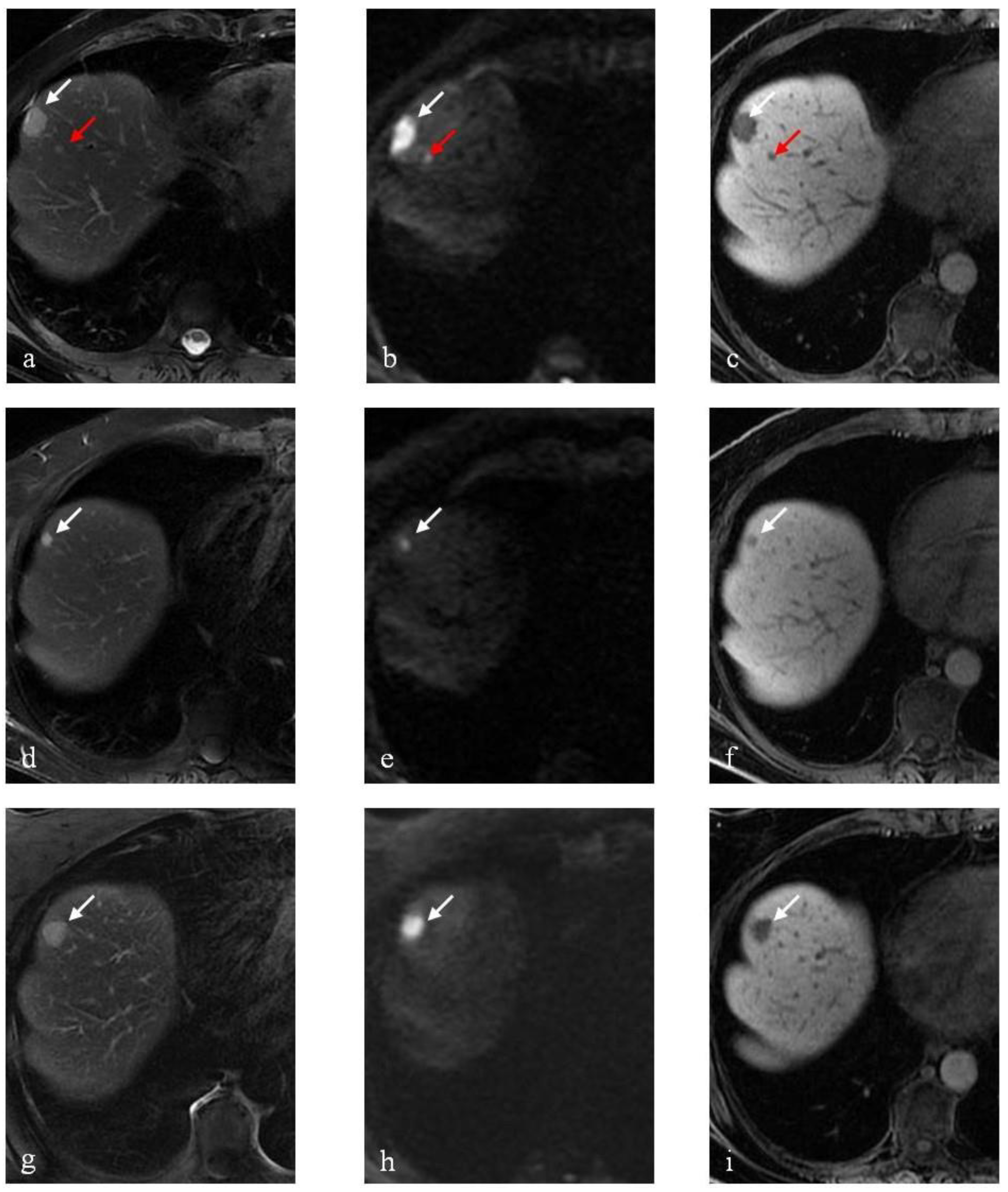 Cancers 15 02200 g005