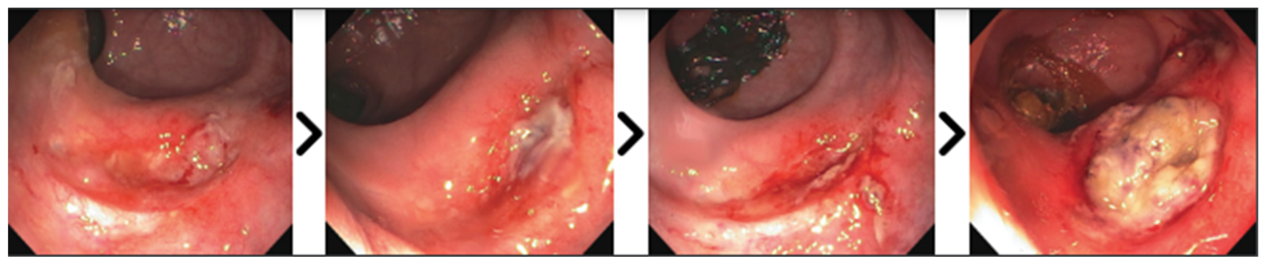 Cancers 15 02214 g001