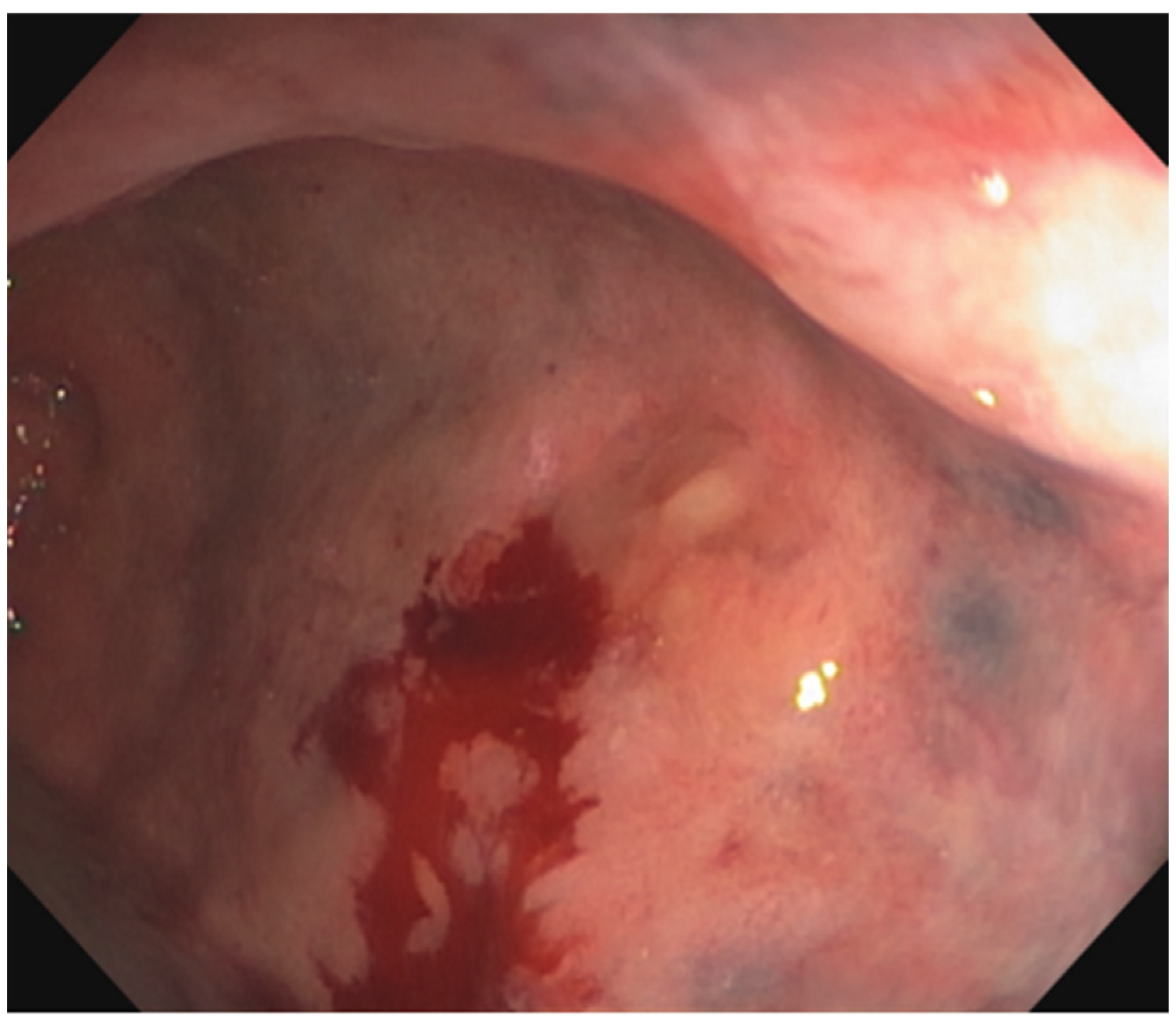 Cancers 15 02214 g002