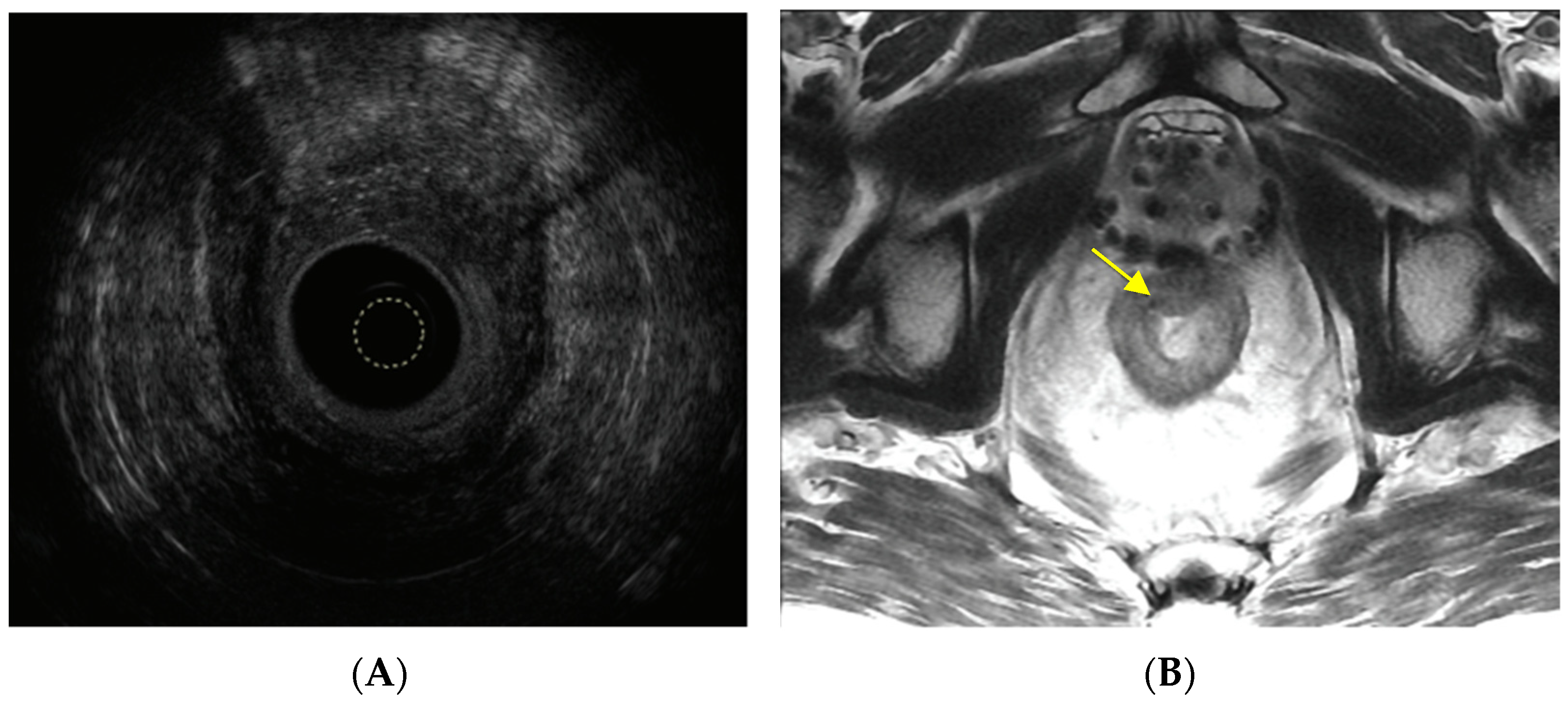 Cancers 15 02214 g003