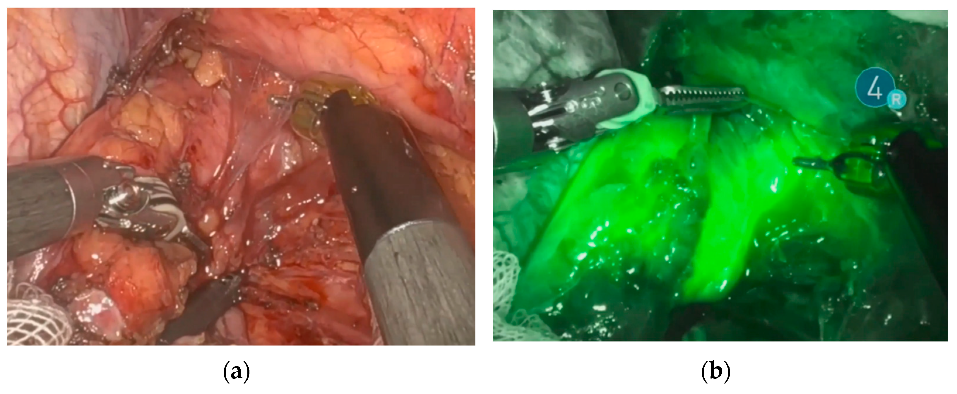 Cancers 15 02247 g002