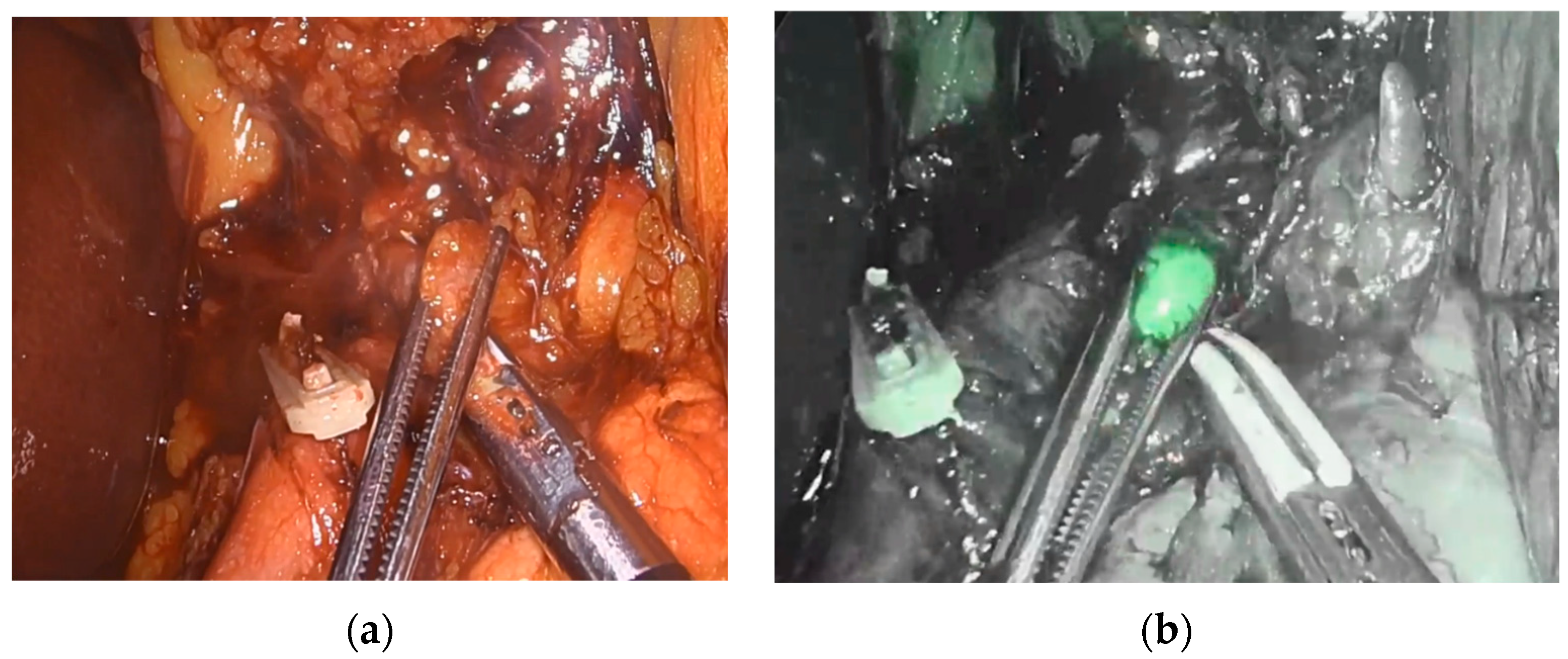 Cancers 15 02247 g003