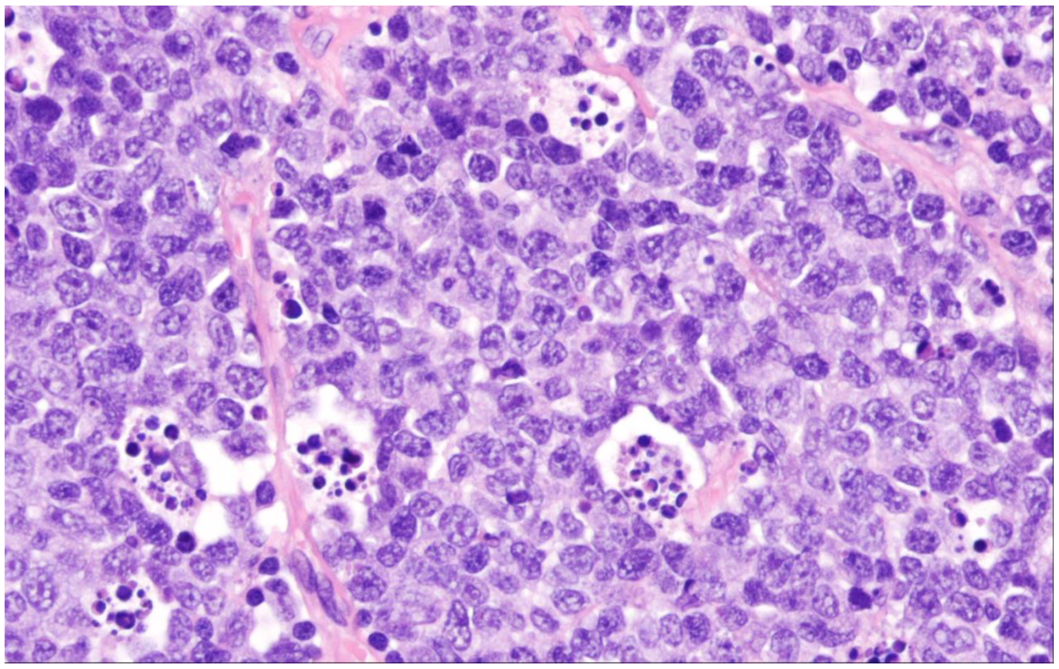 Cancers 15 02285 g005