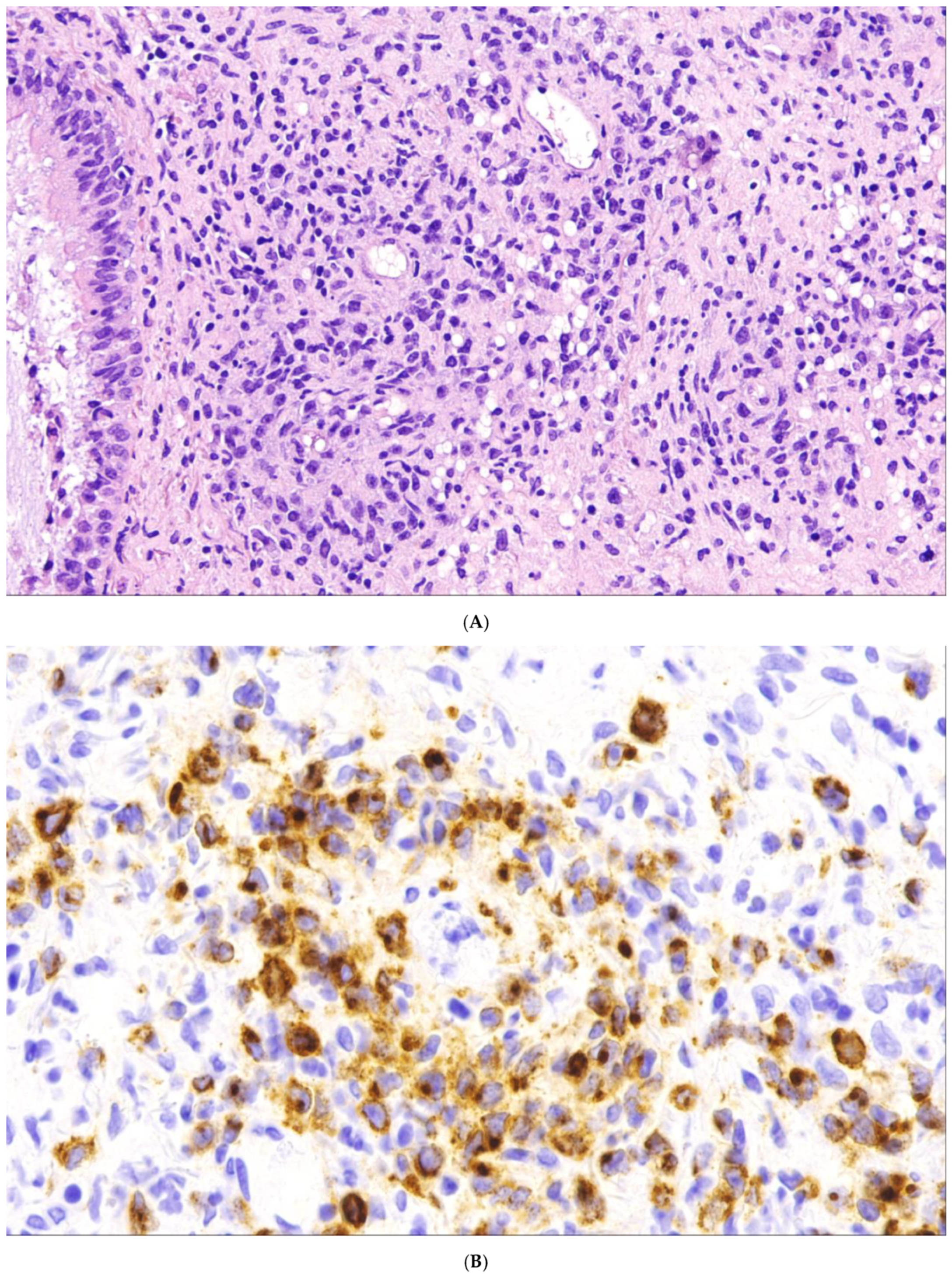 Cancers 15 02285 g006