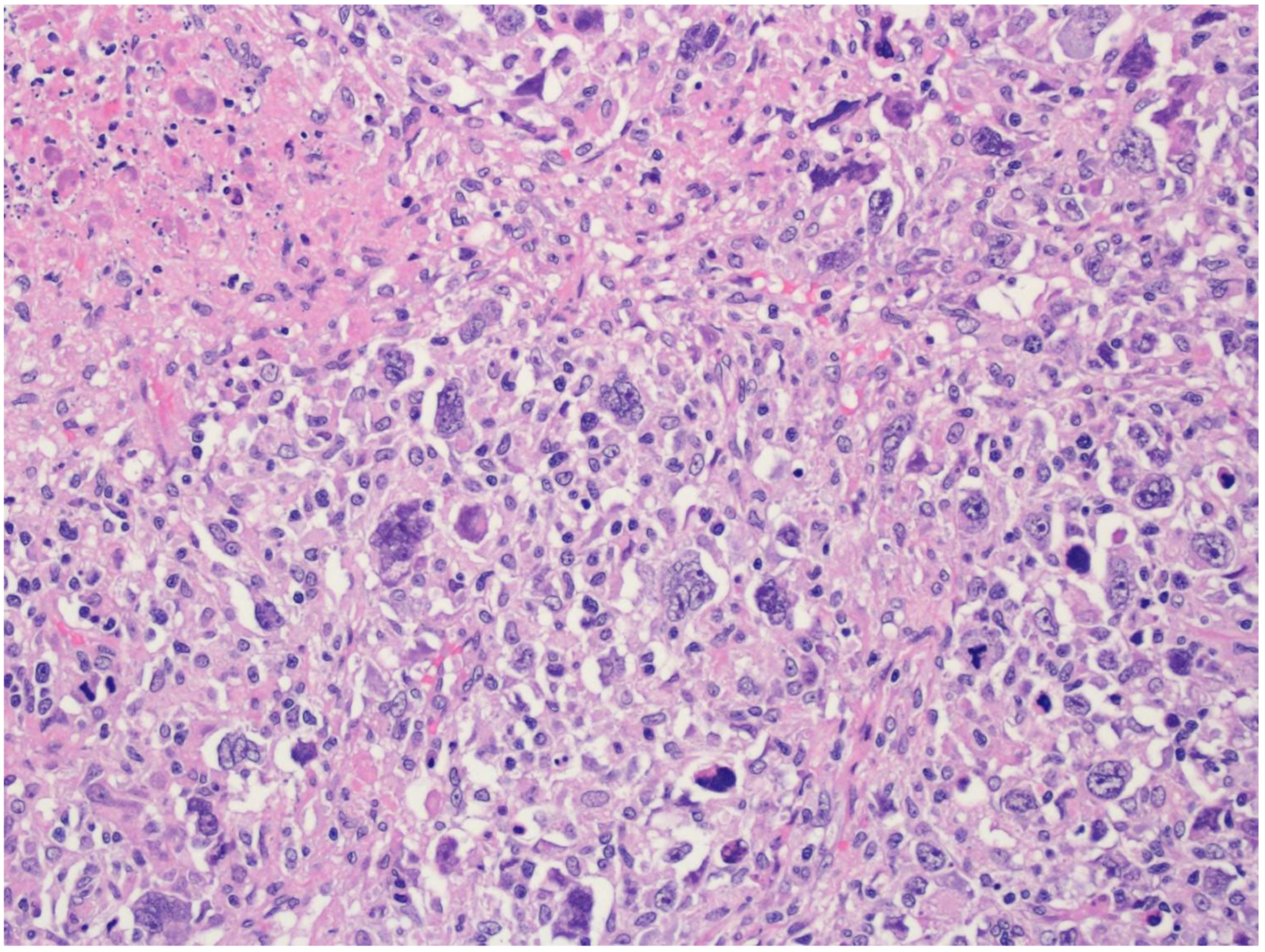 Cancers 15 02285 g007