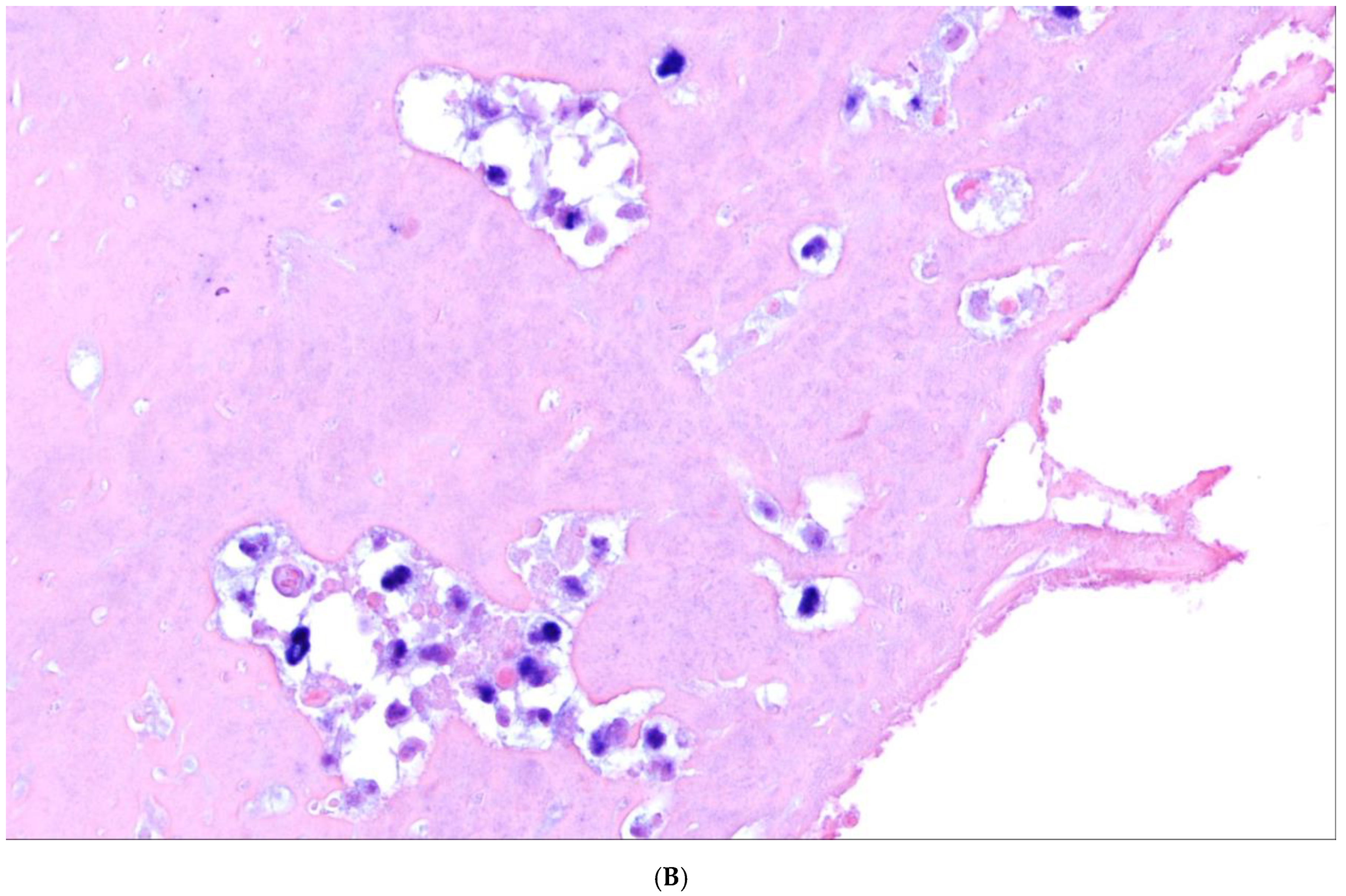 Cancers 15 02285 g008b