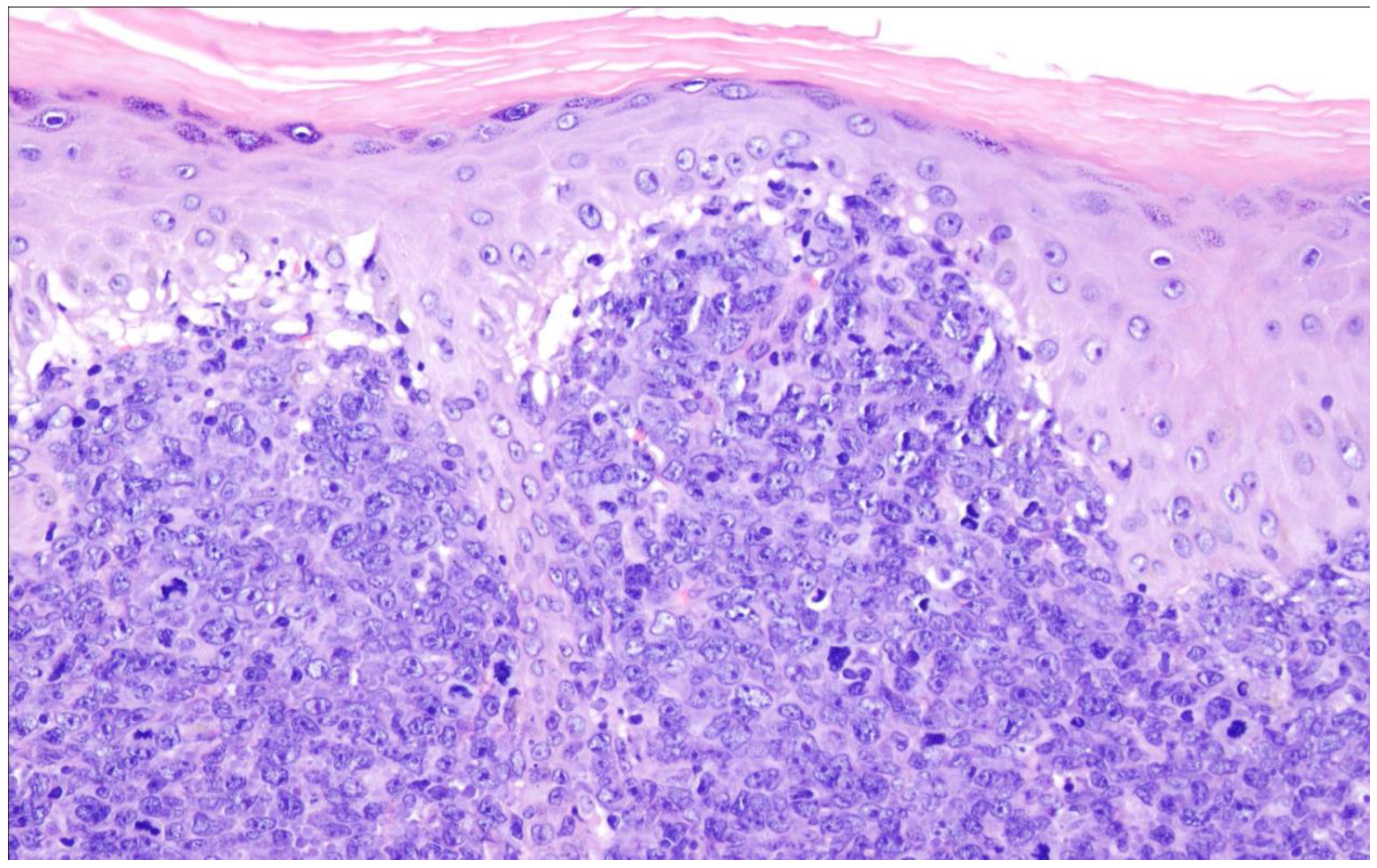 Cancers 15 02285 g012