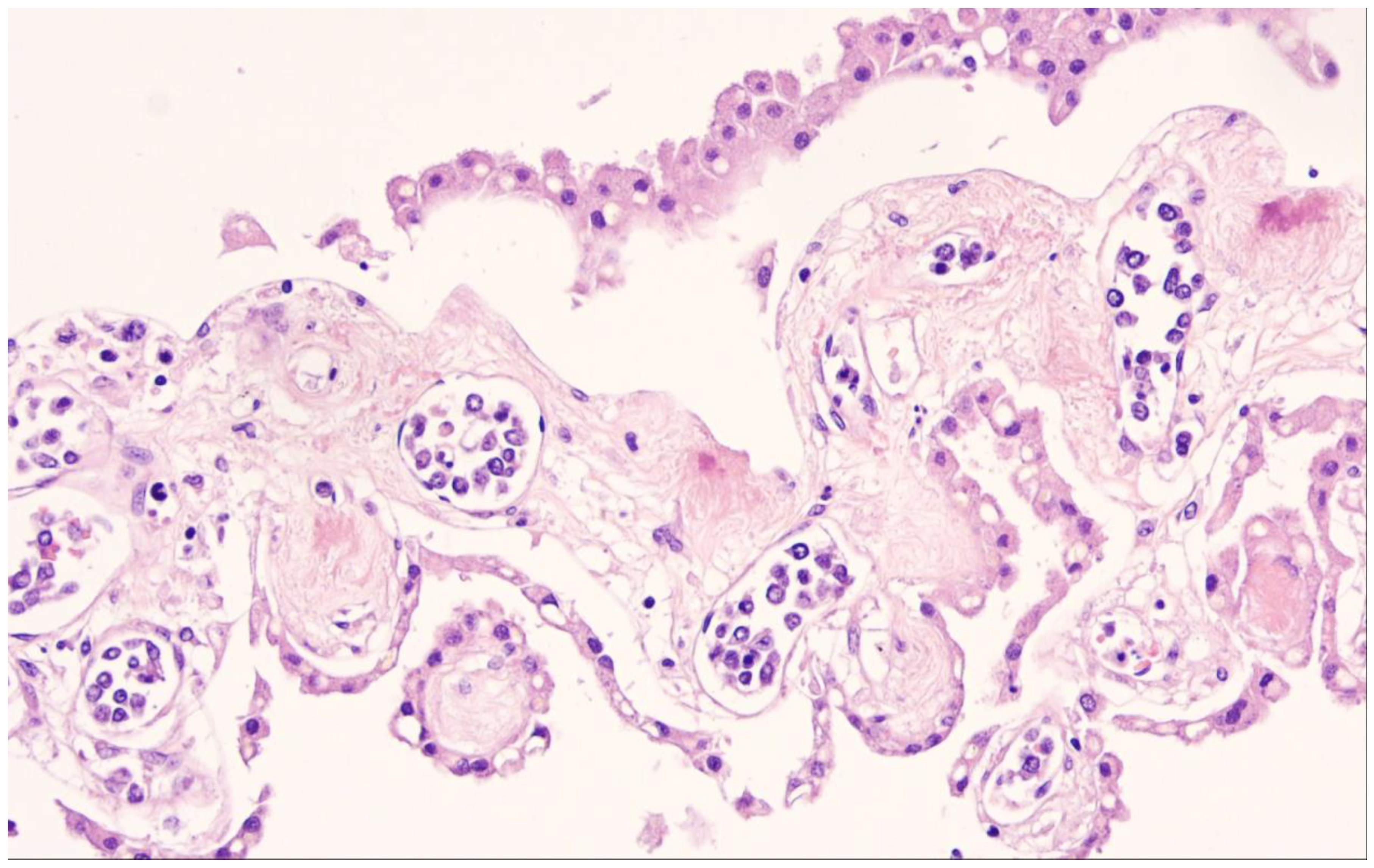 Cancers 15 02285 g013