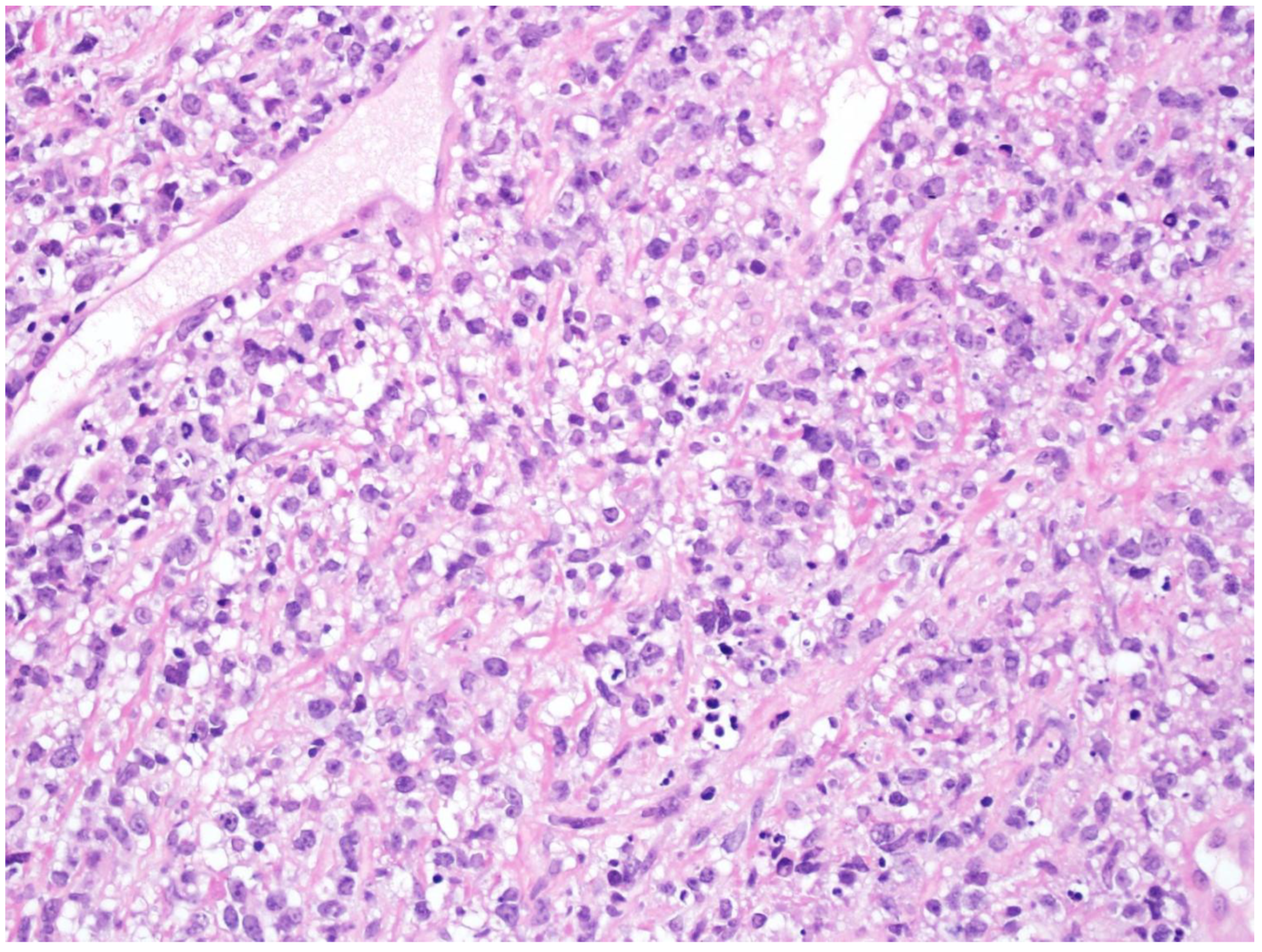 Cancers 15 02285 g014