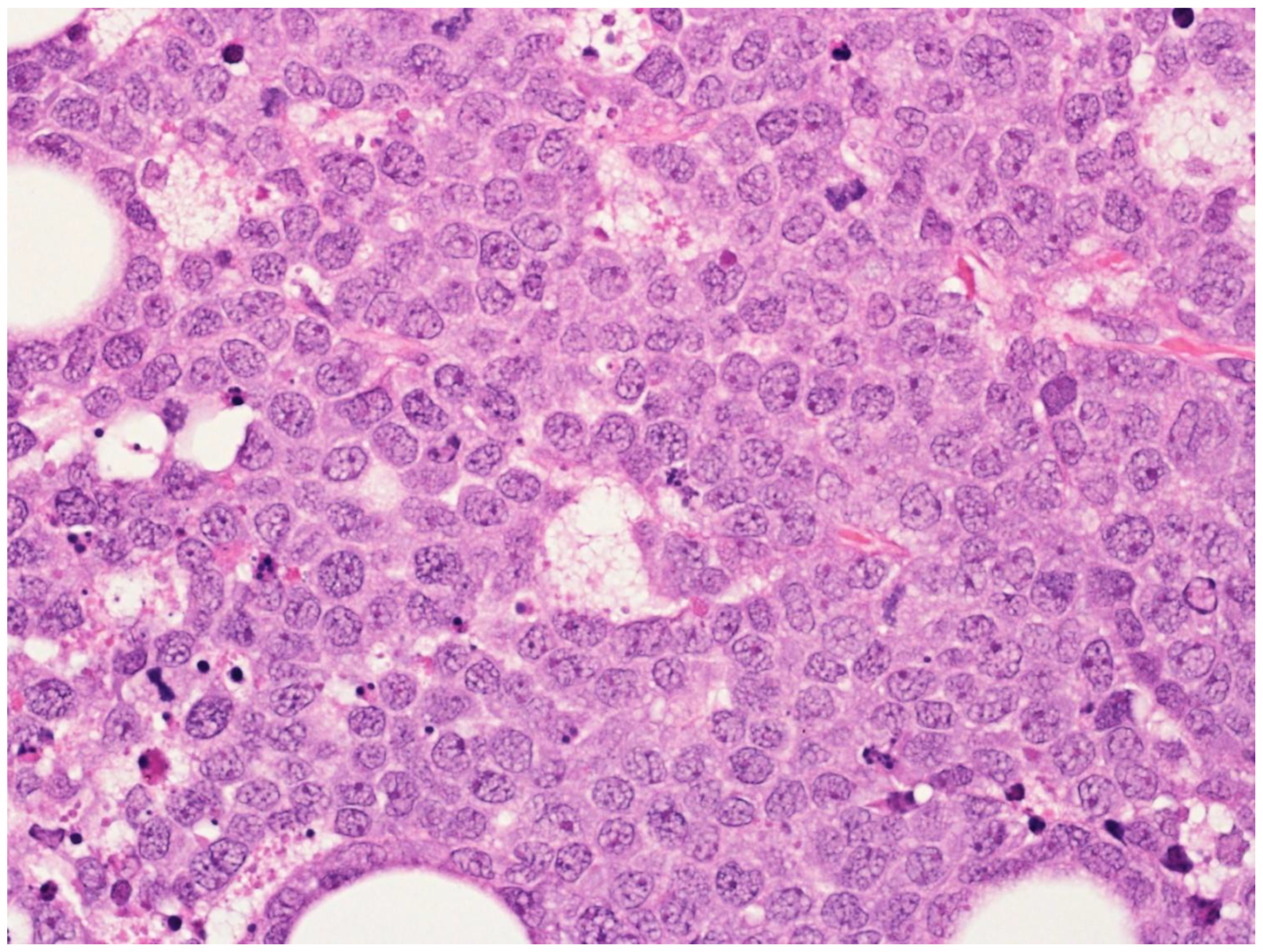 Cancers 15 02285 g015