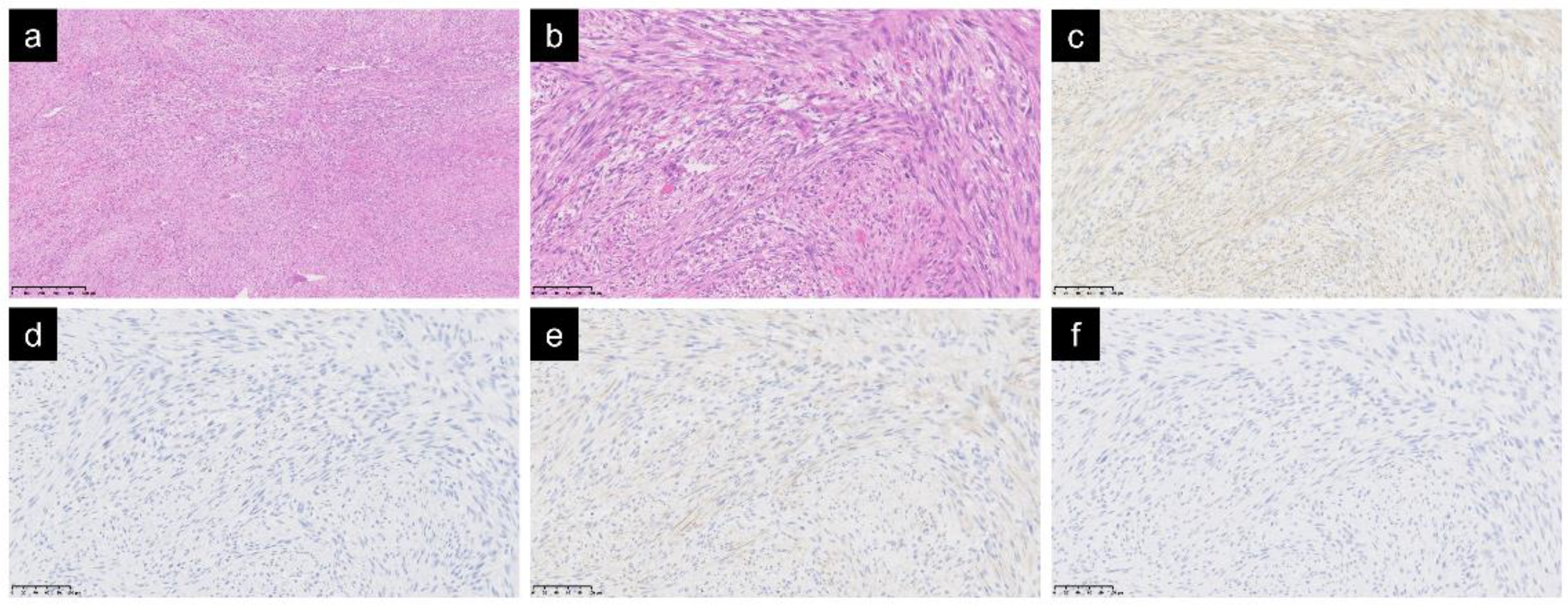 Cancers 15 02314 g001