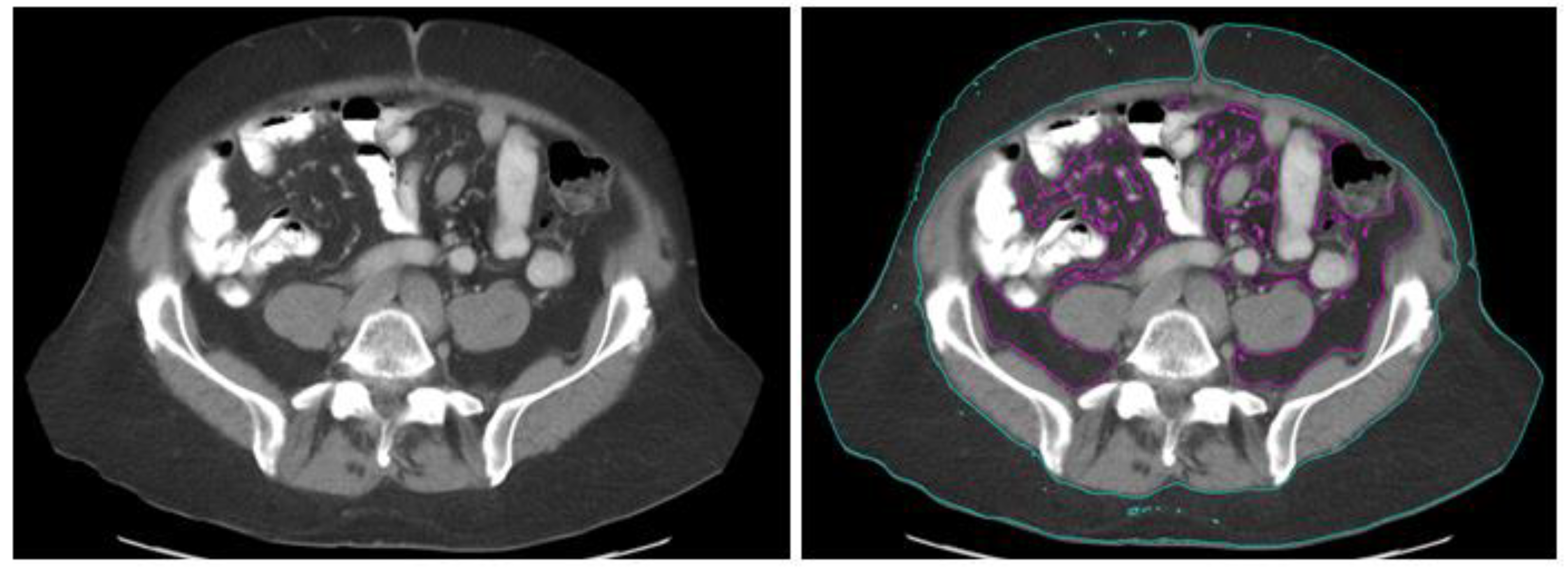 Cancers 15 02329 g001