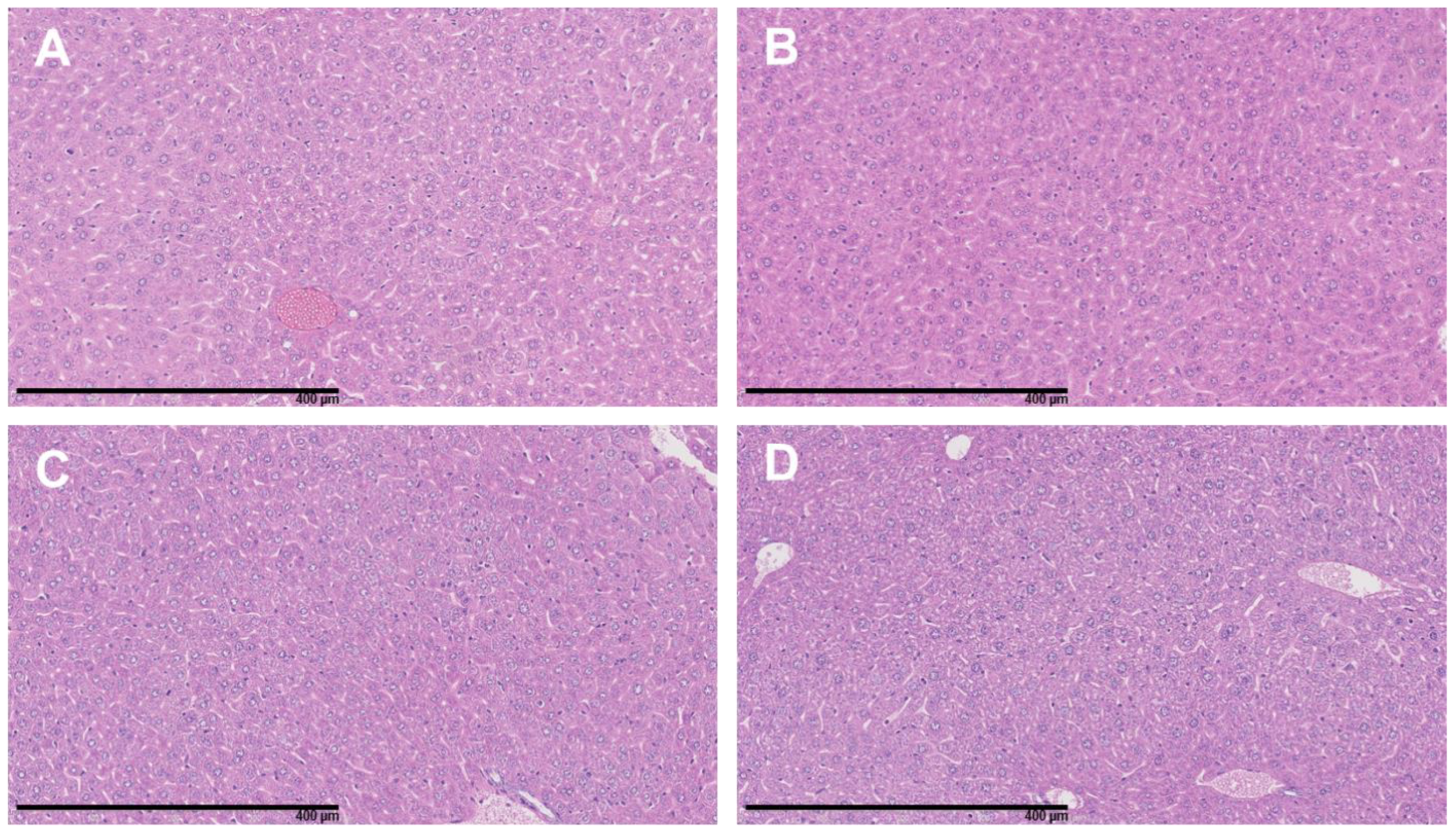 Cancers 15 02332 g010