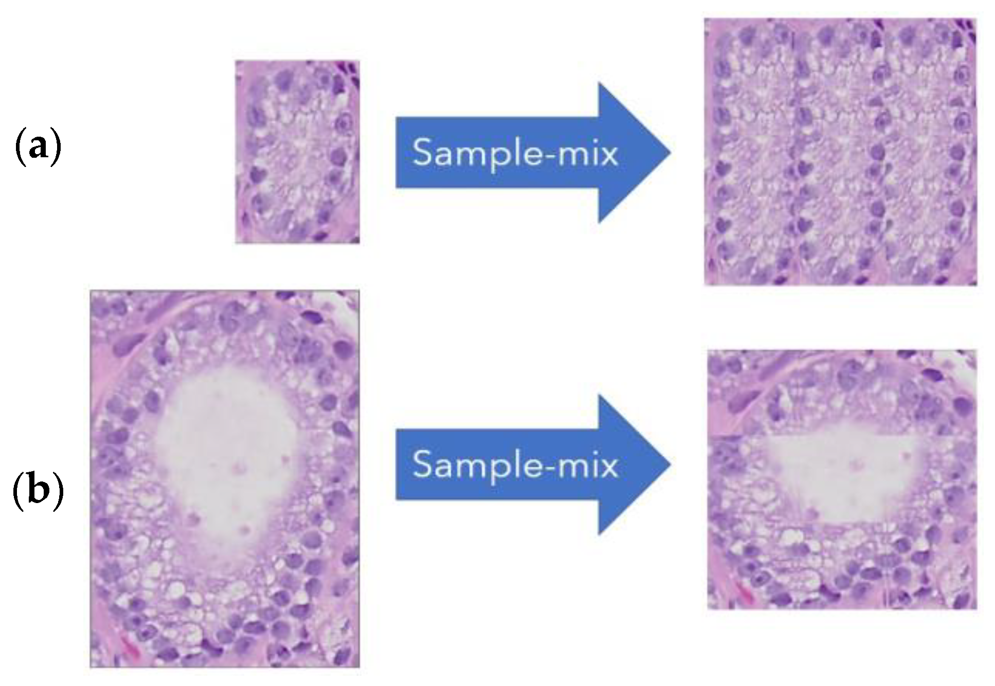 Cancers 15 02335 g004