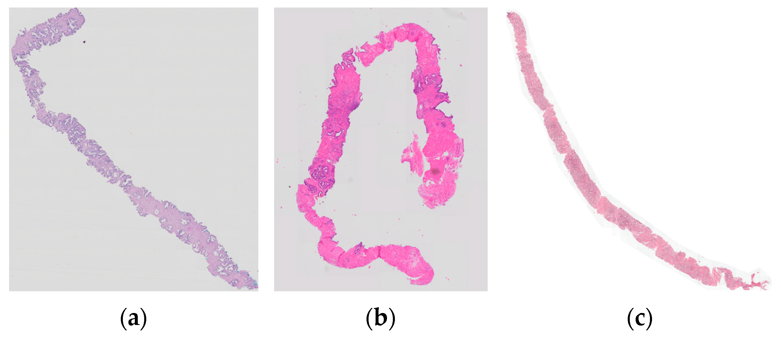 Cancers 15 02335 g005