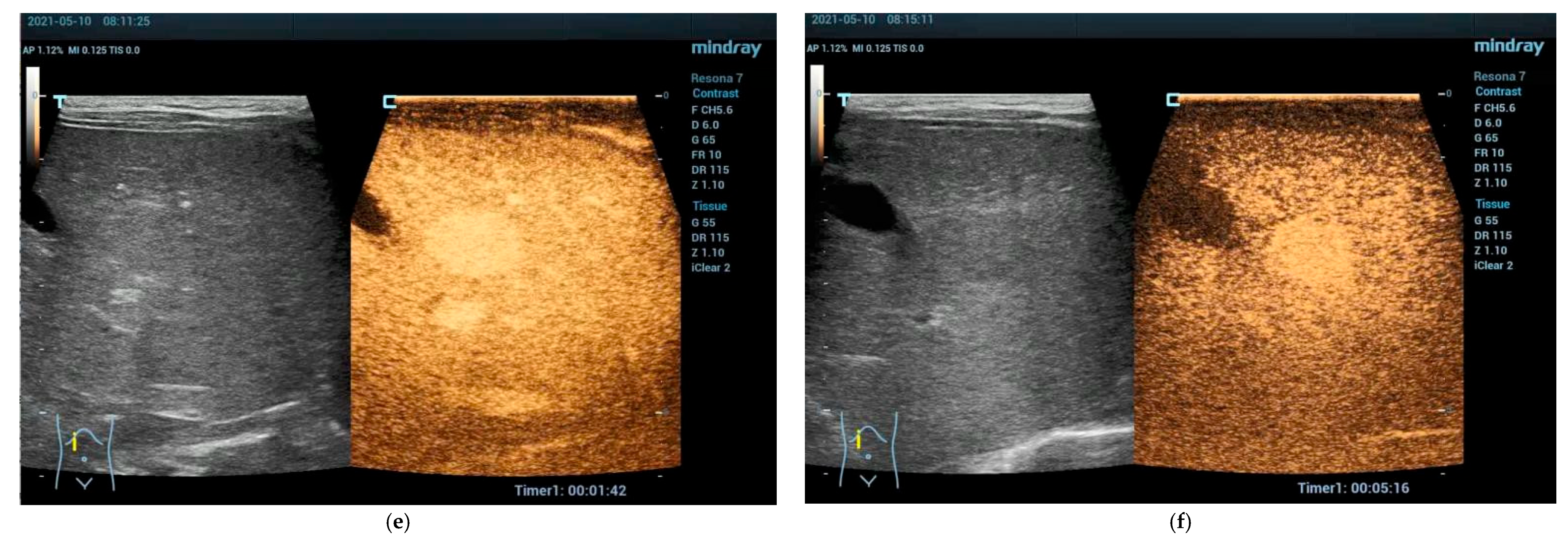 Cancers 15 02360 g001b