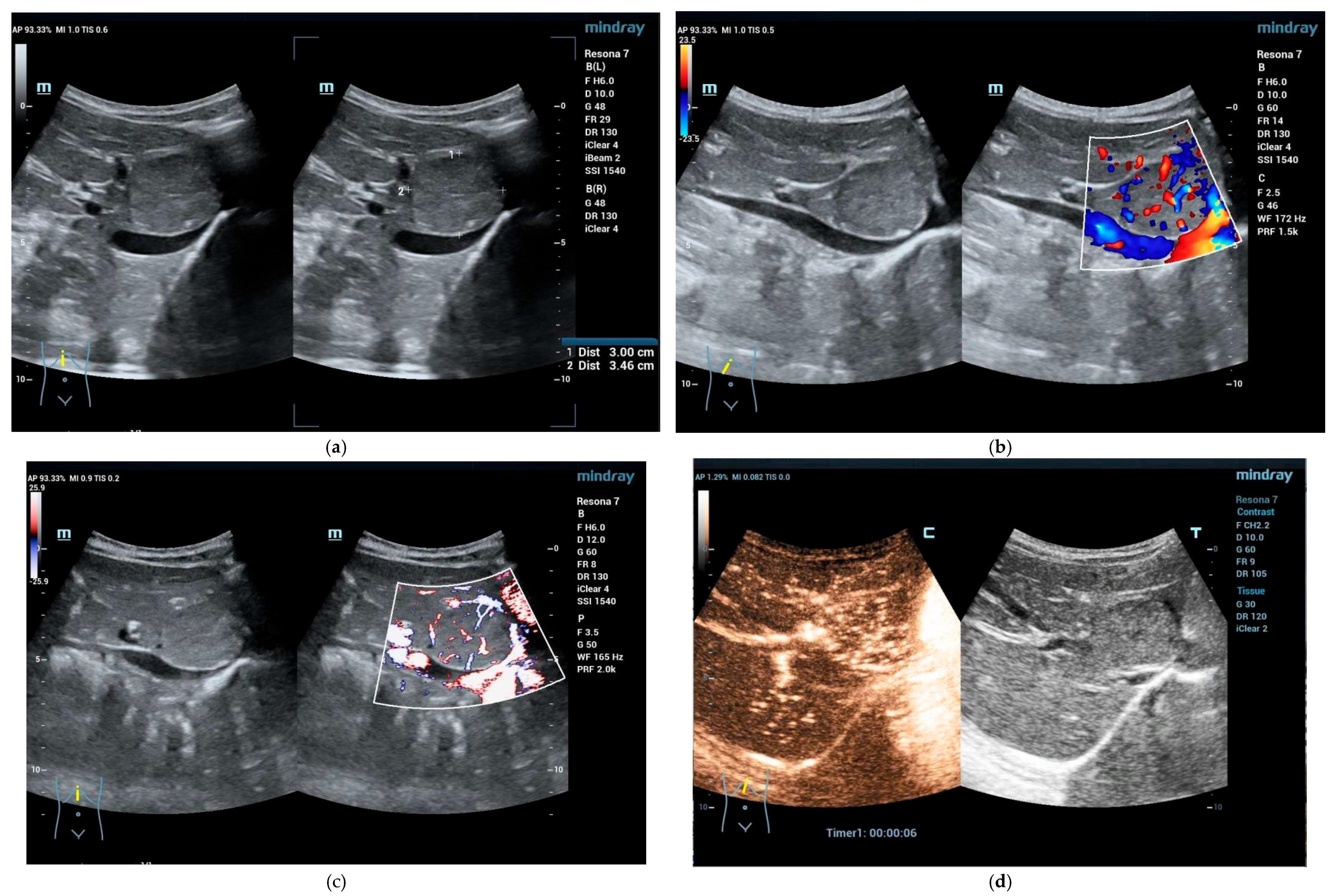 Cancers 15 02360 g002a