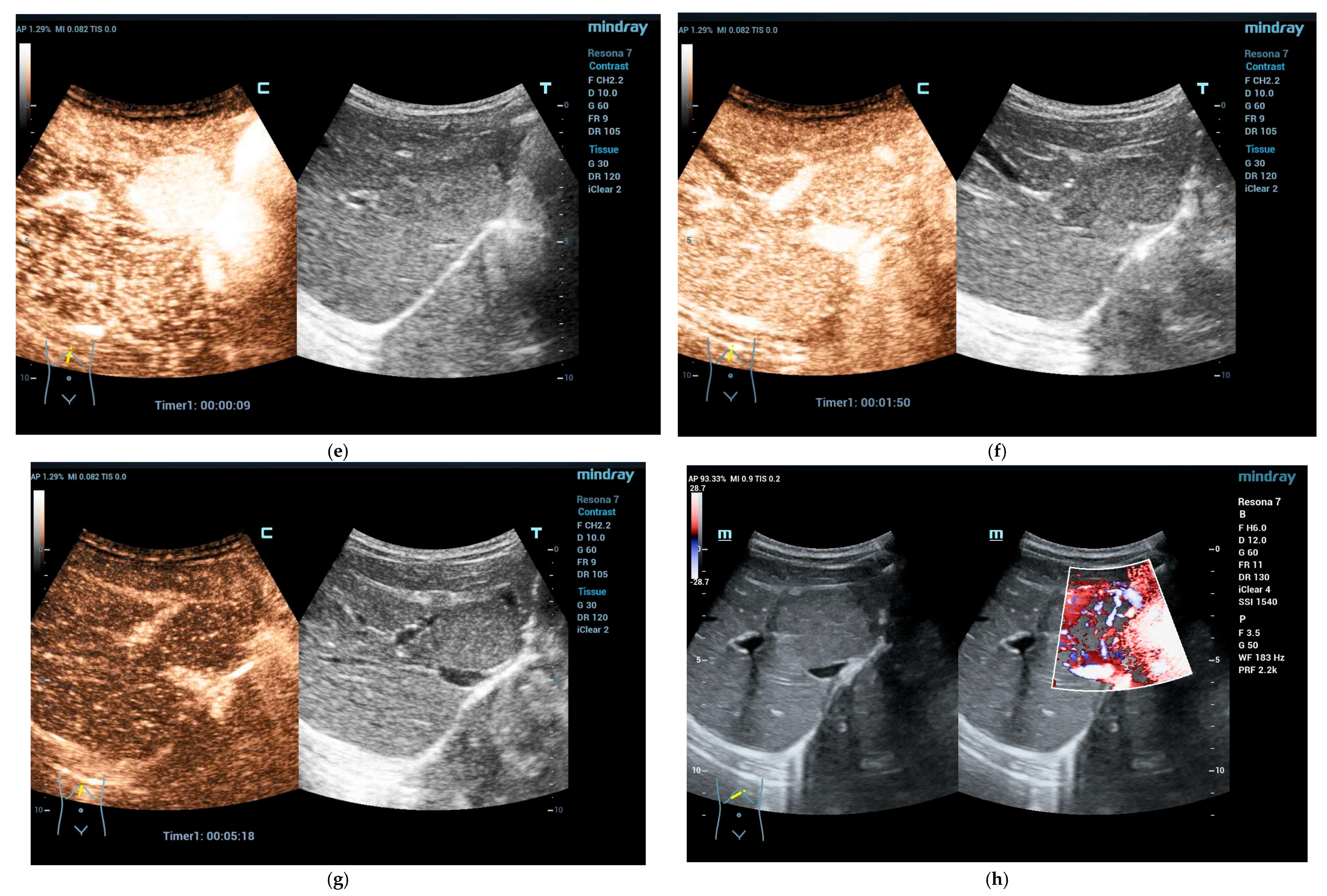 Cancers 15 02360 g002b