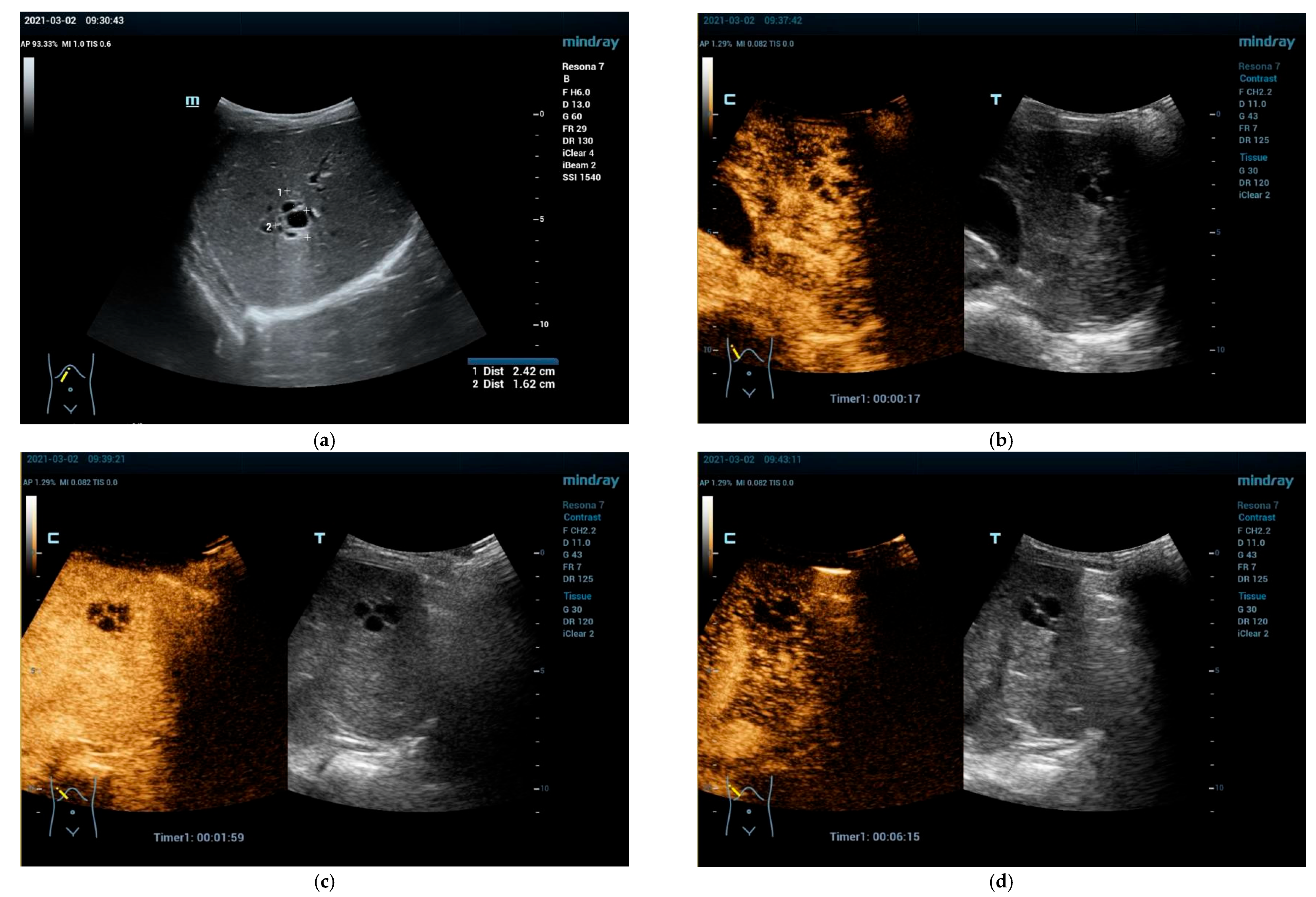 Cancers 15 02360 g003