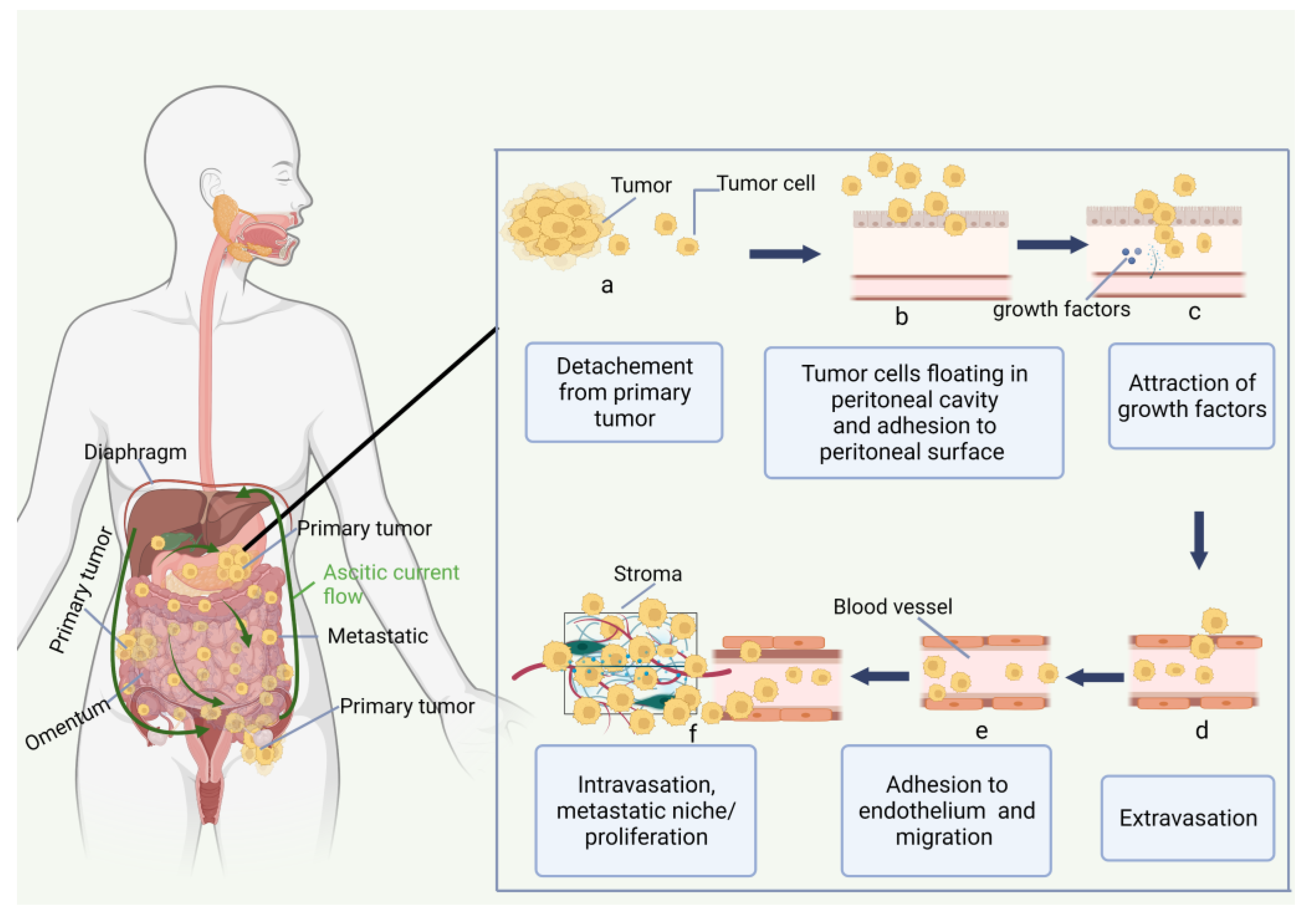 Cancers 15 02383 g001