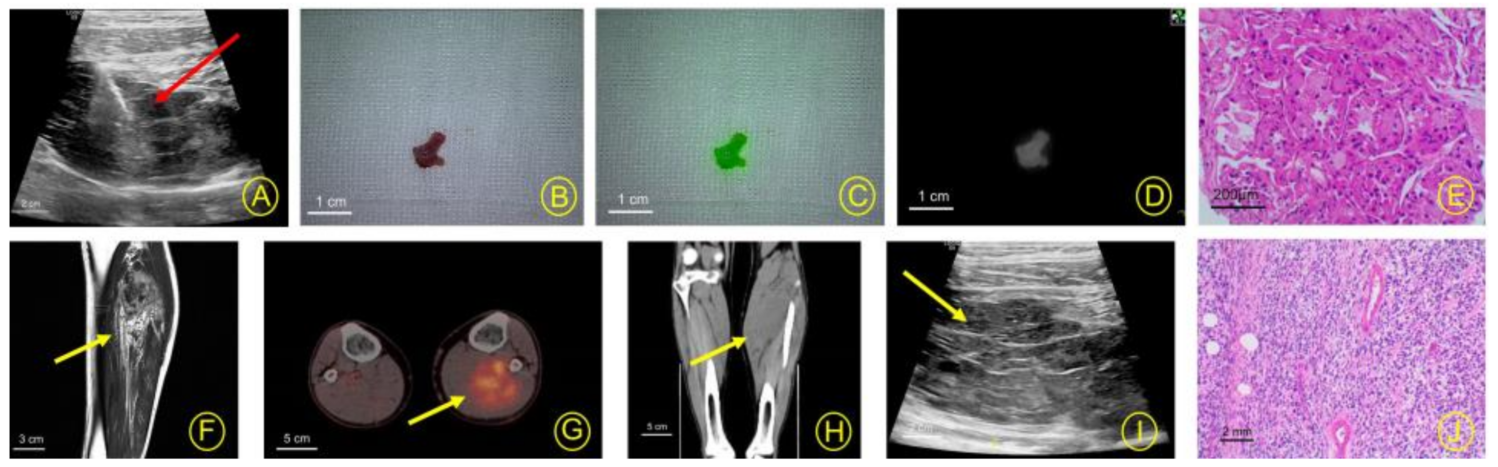 Cancers 15 02402 g003