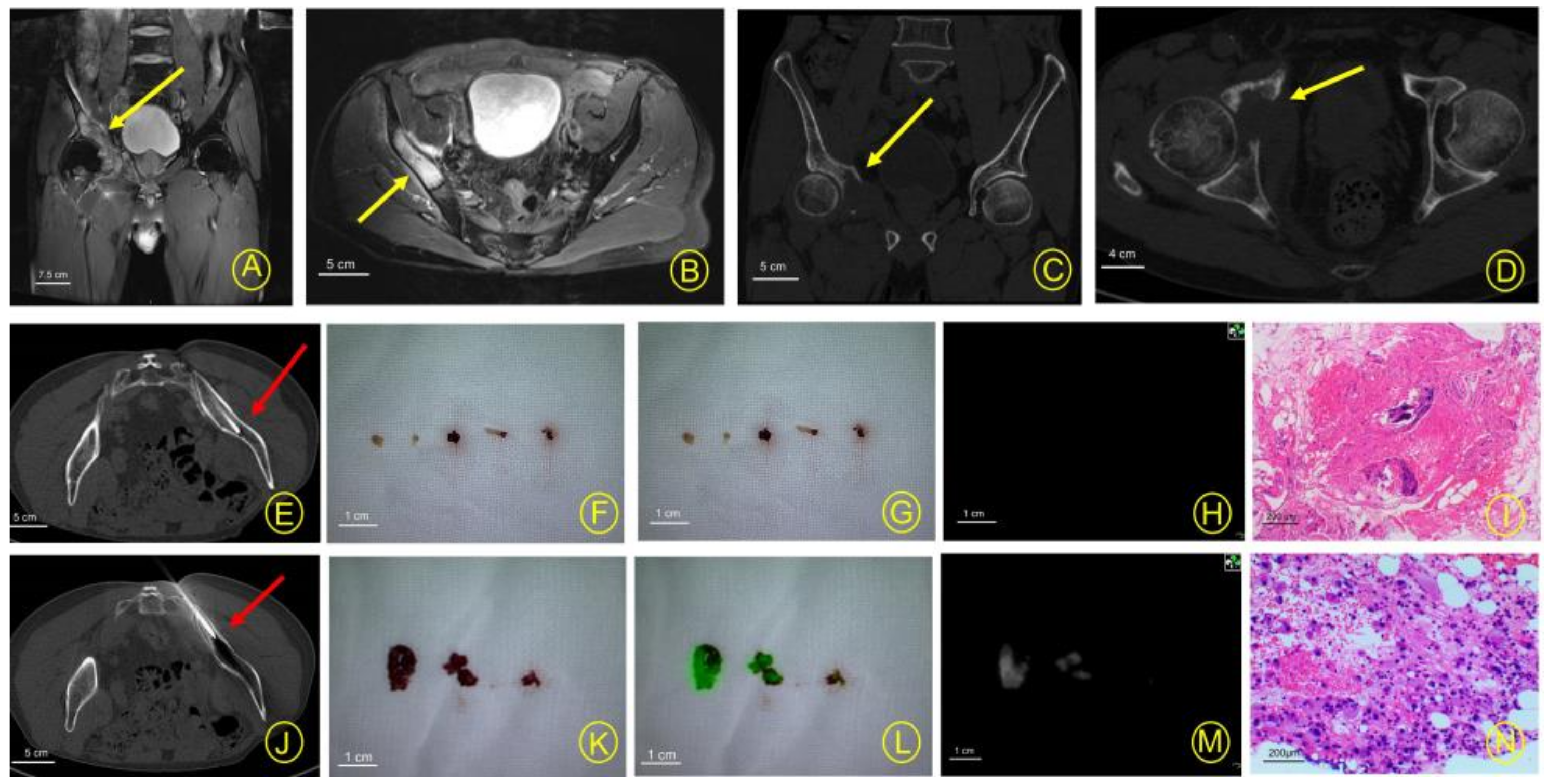 Cancers 15 02402 g004