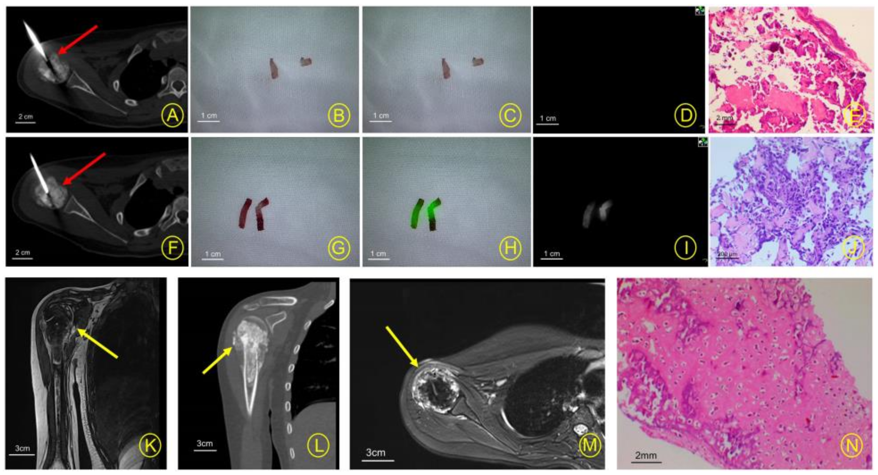 Cancers 15 02402 g005