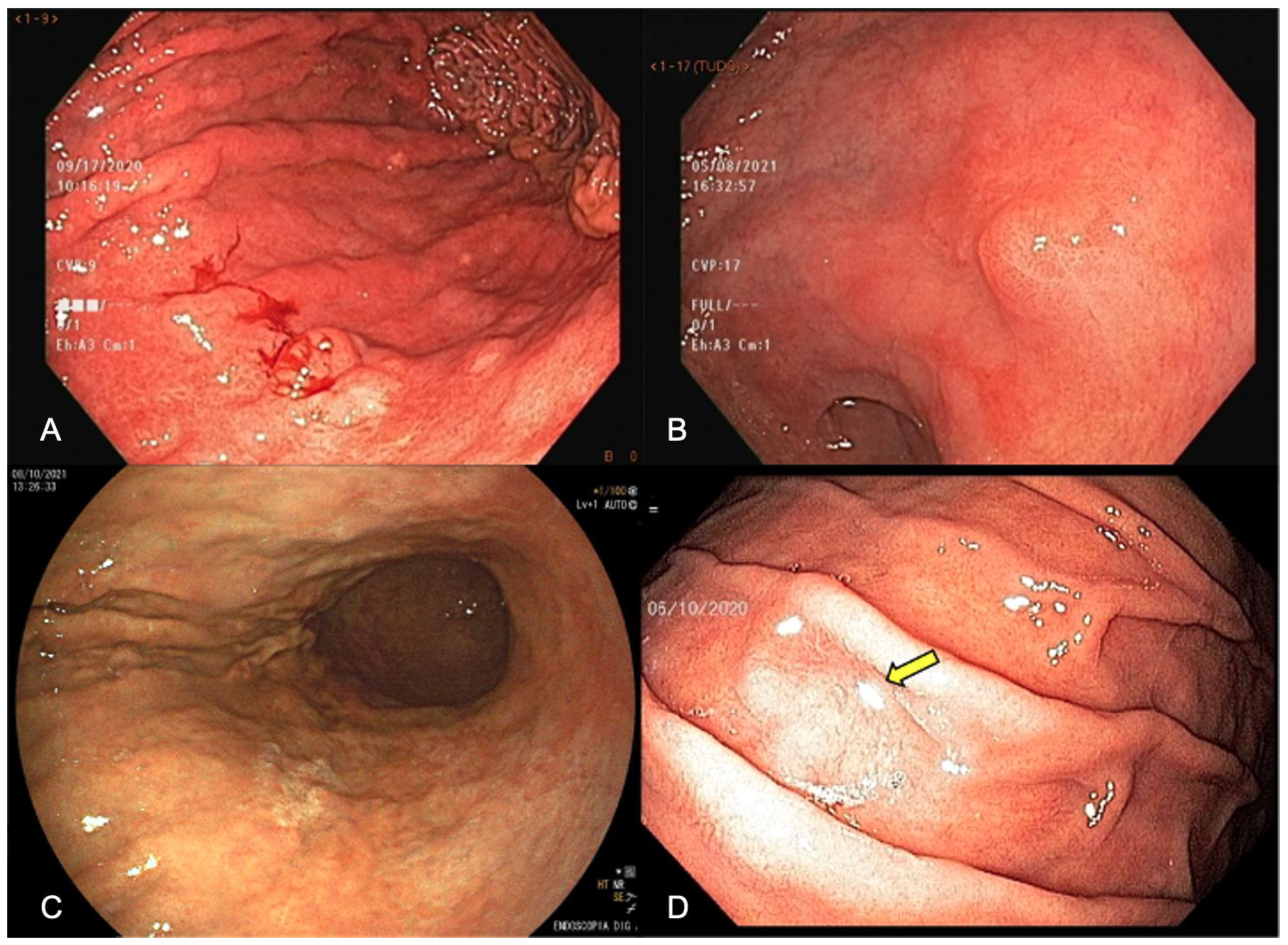 Cancers 15 02445 g001