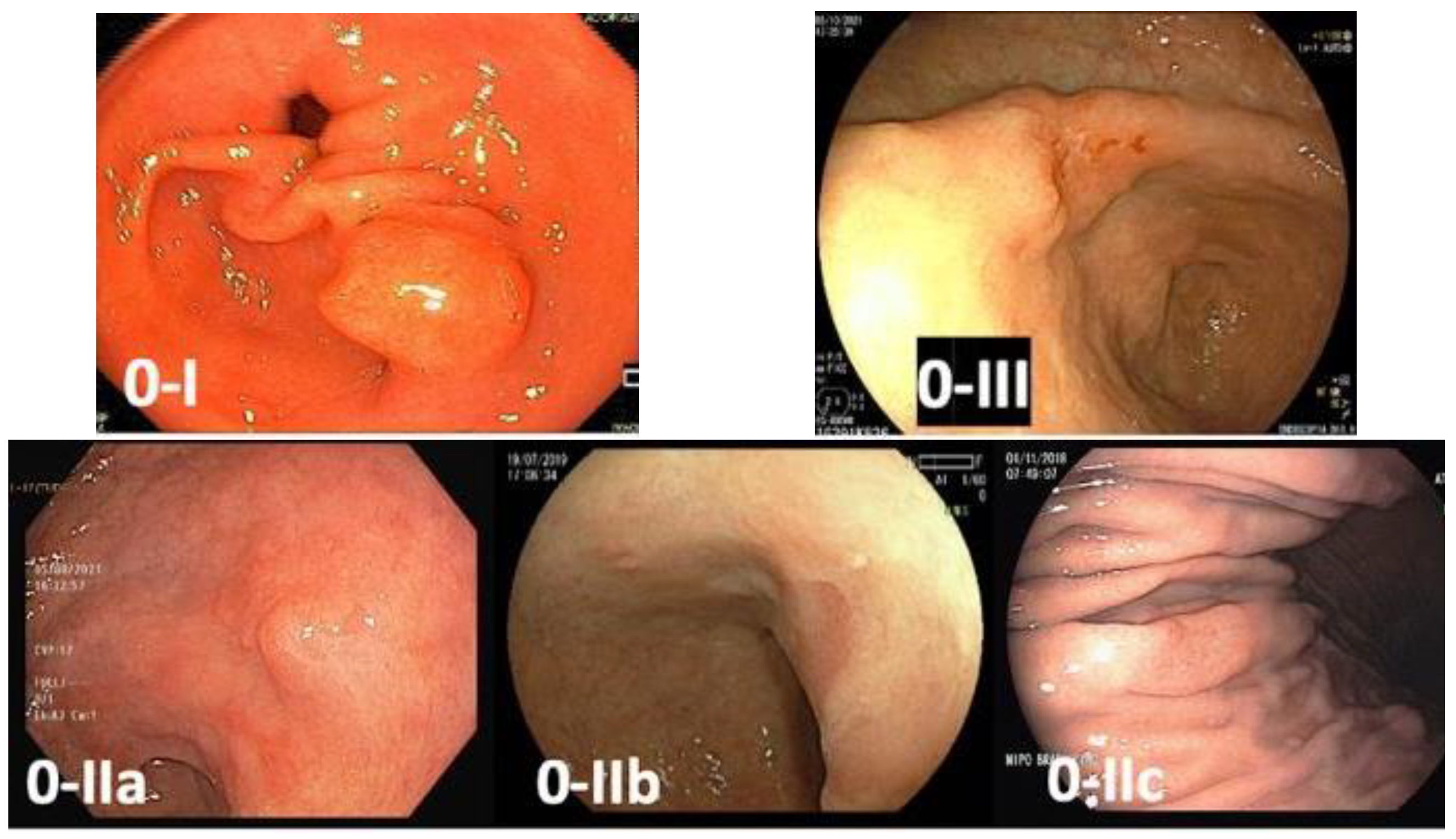 Cancers 15 02445 g002