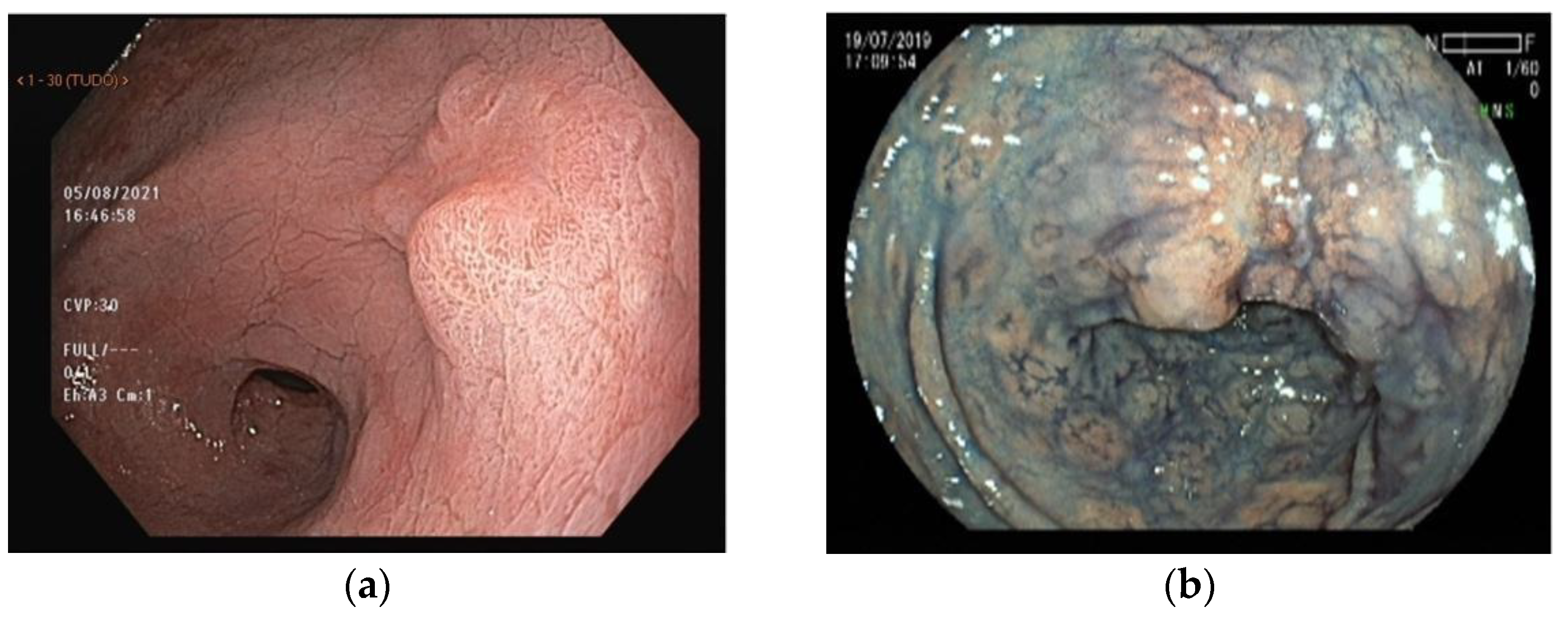 Cancers 15 02445 g003