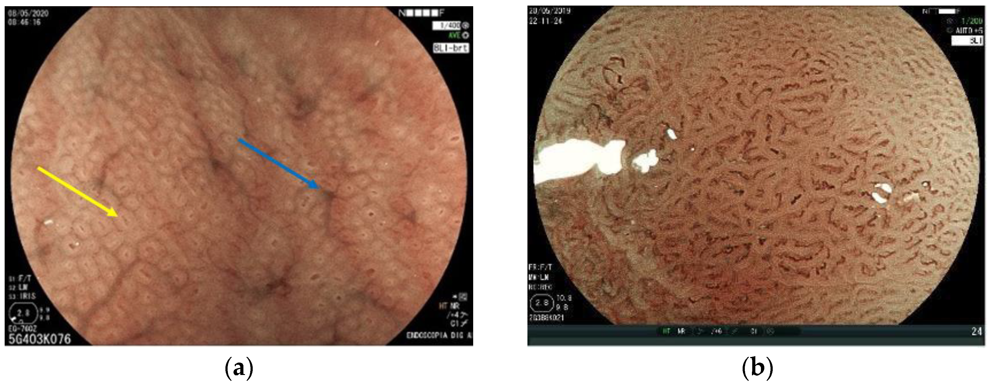 Cancers 15 02445 g004