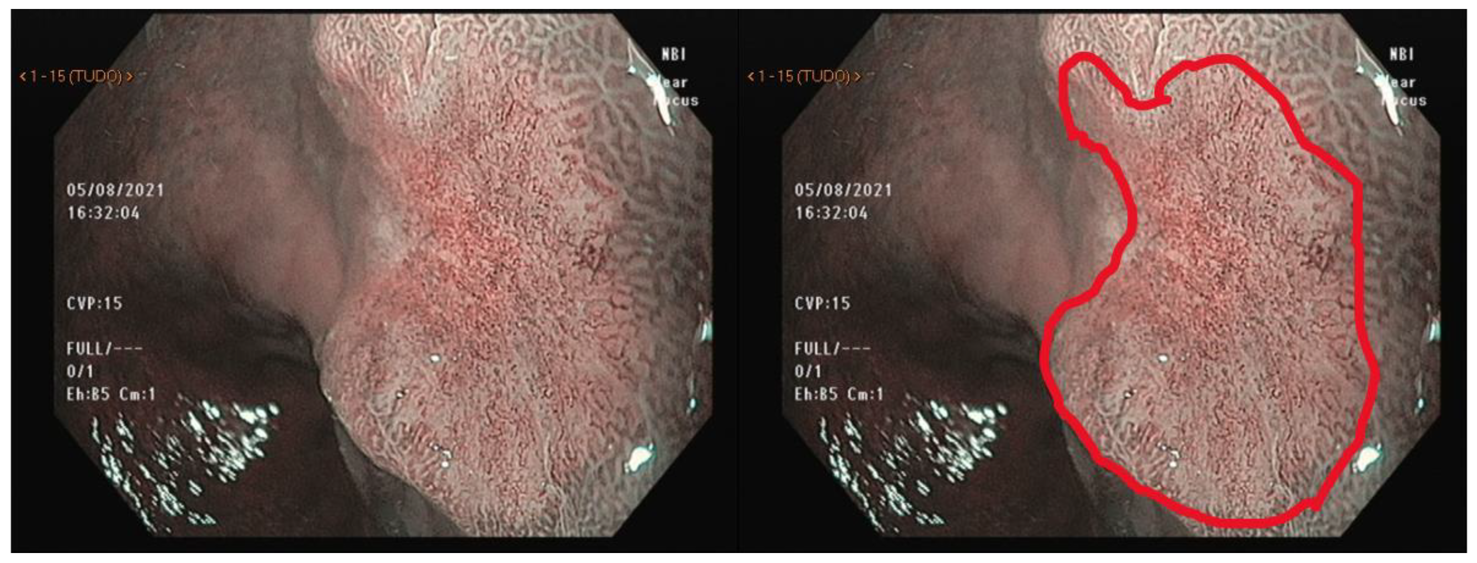 Cancers 15 02445 g005