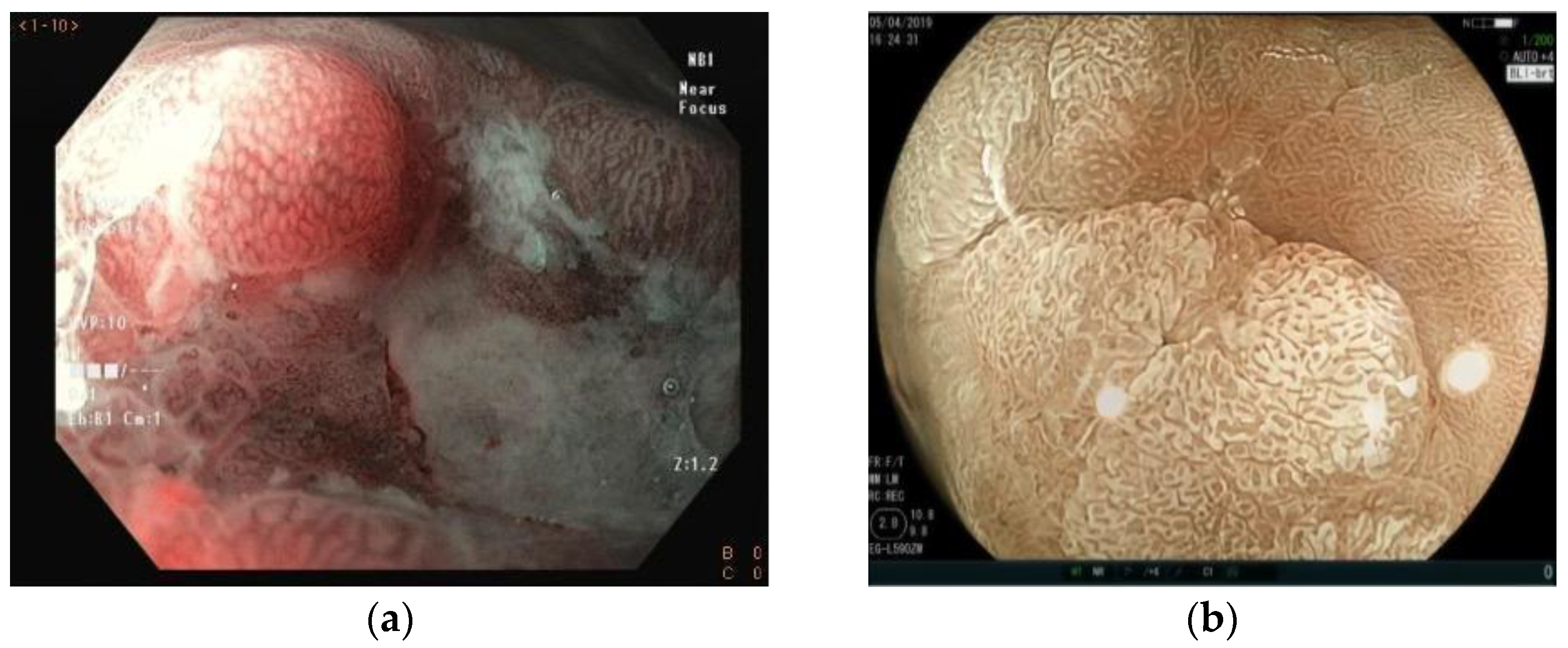 Cancers 15 02445 g006