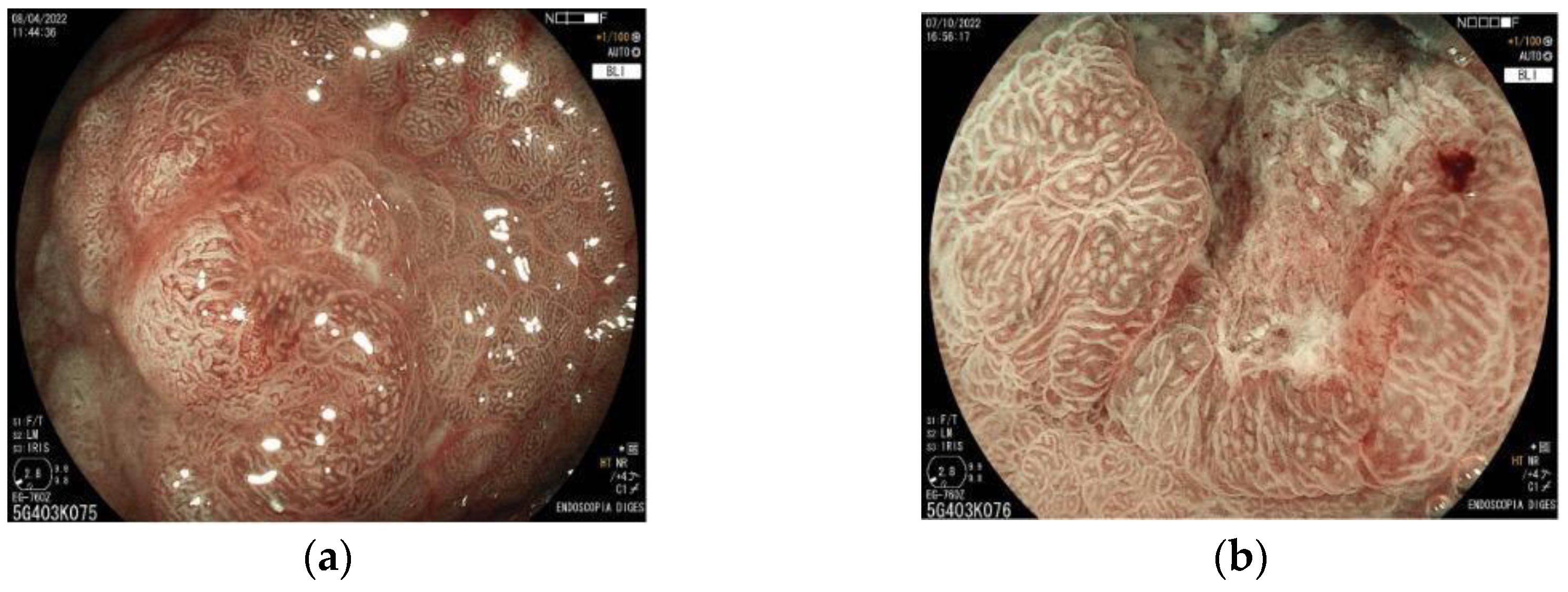 Cancers 15 02445 g007