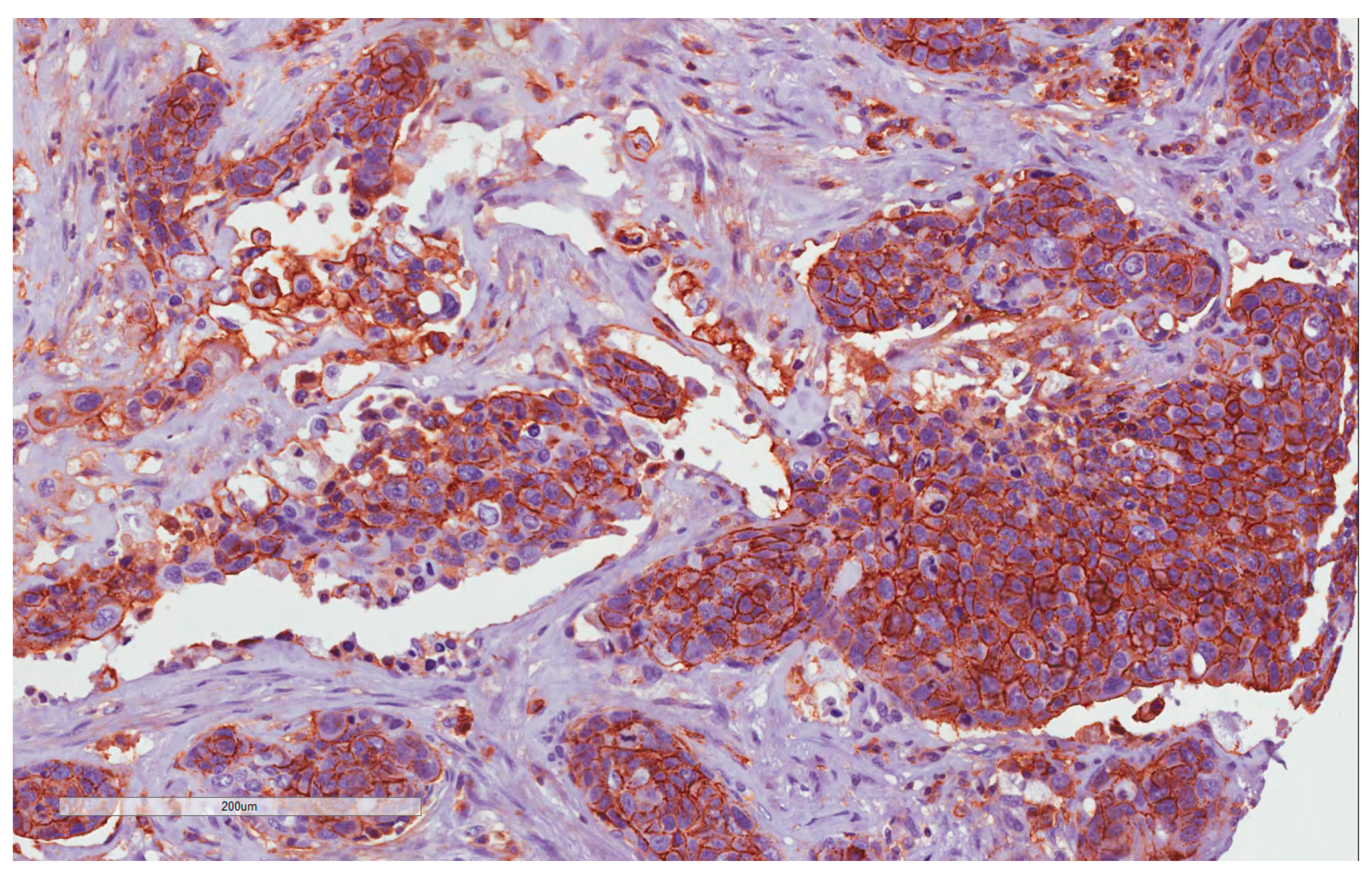 Cancers 15 02461 g002