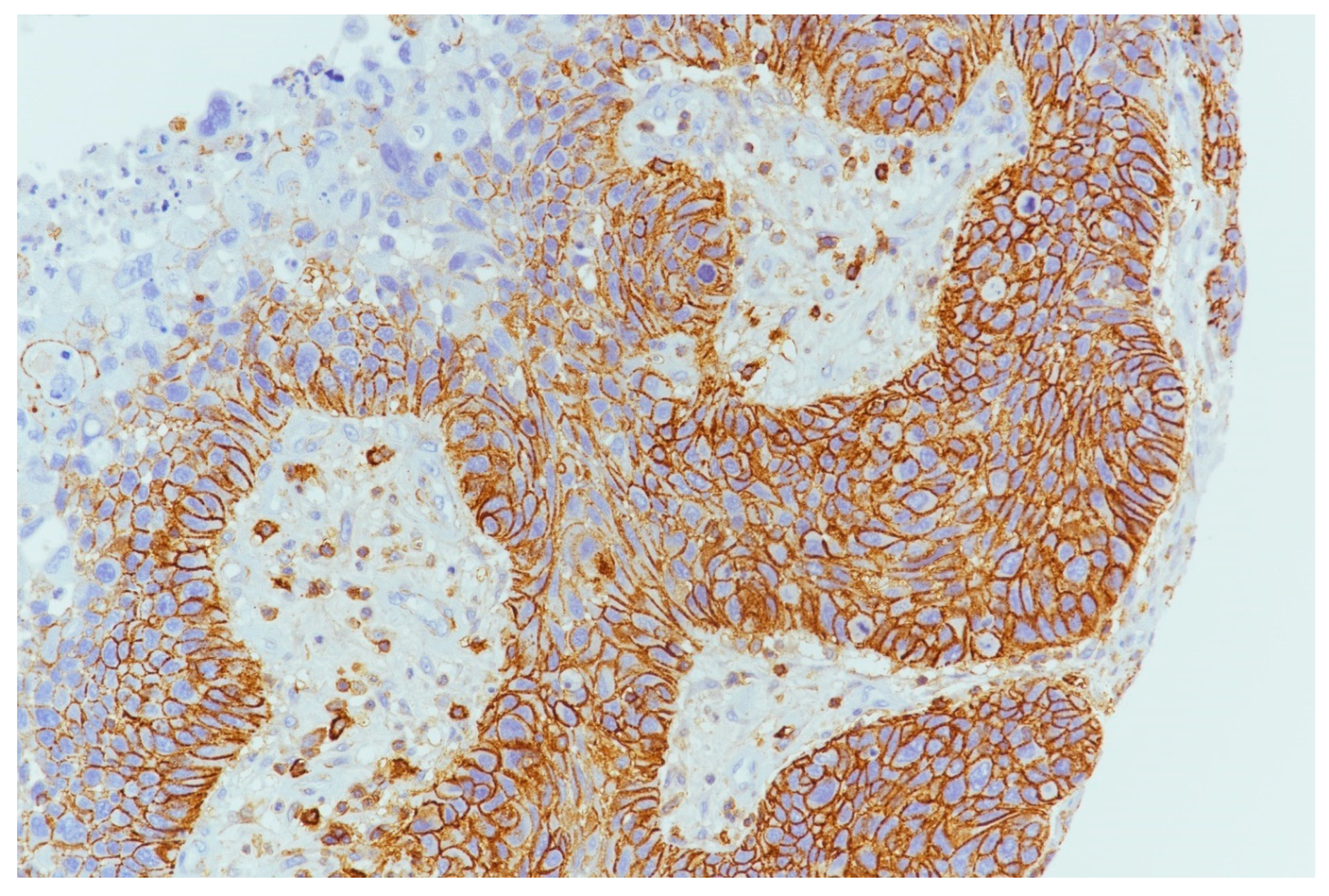 Cancers 15 02461 g004