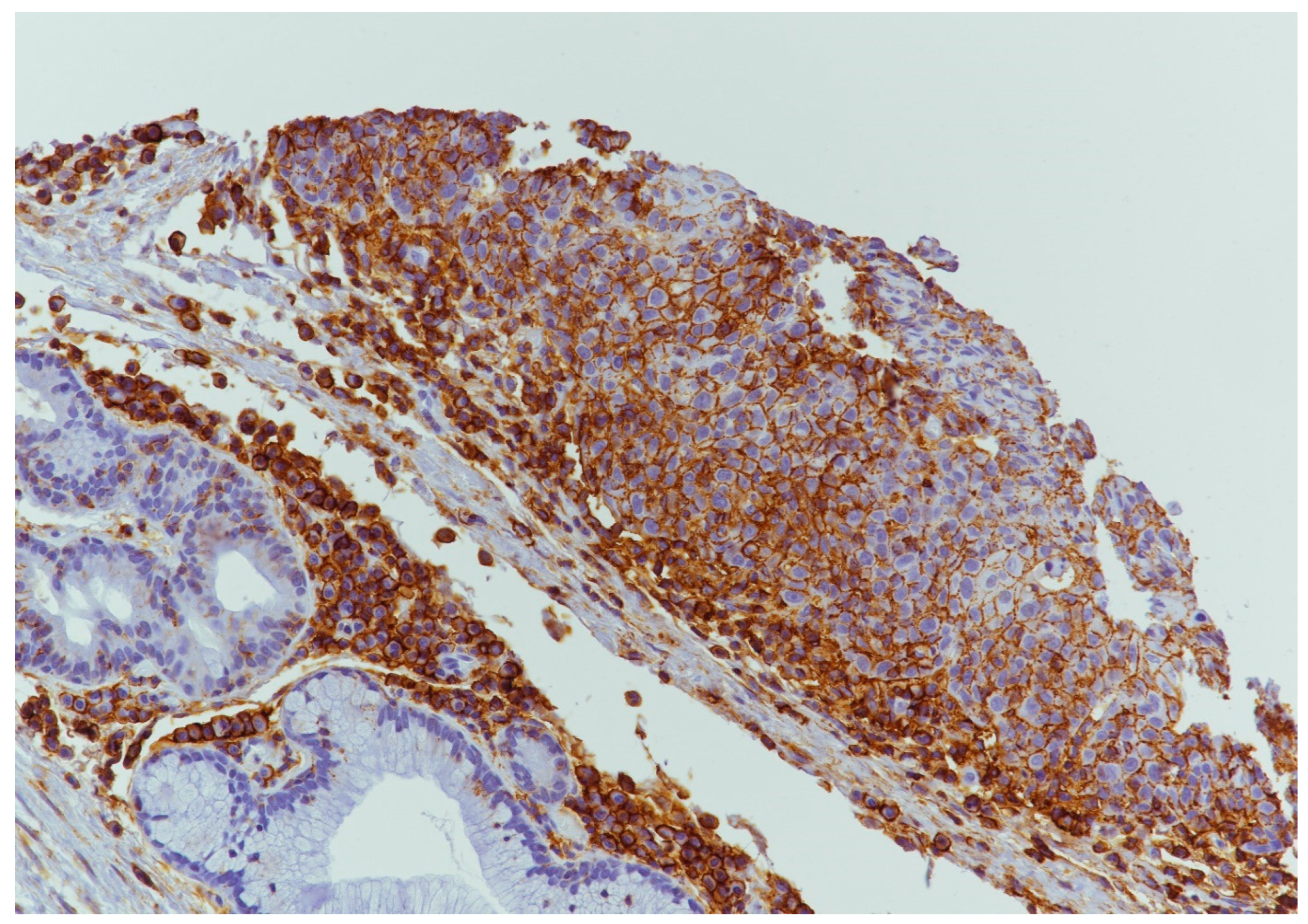 Cancers 15 02461 g005