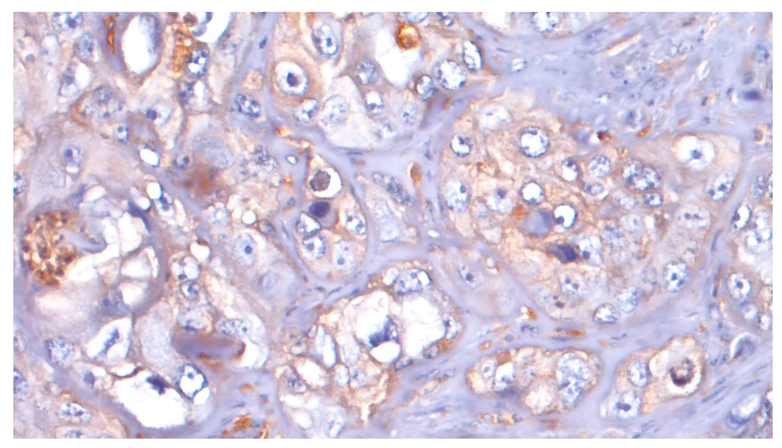 Cancers 15 02461 g007